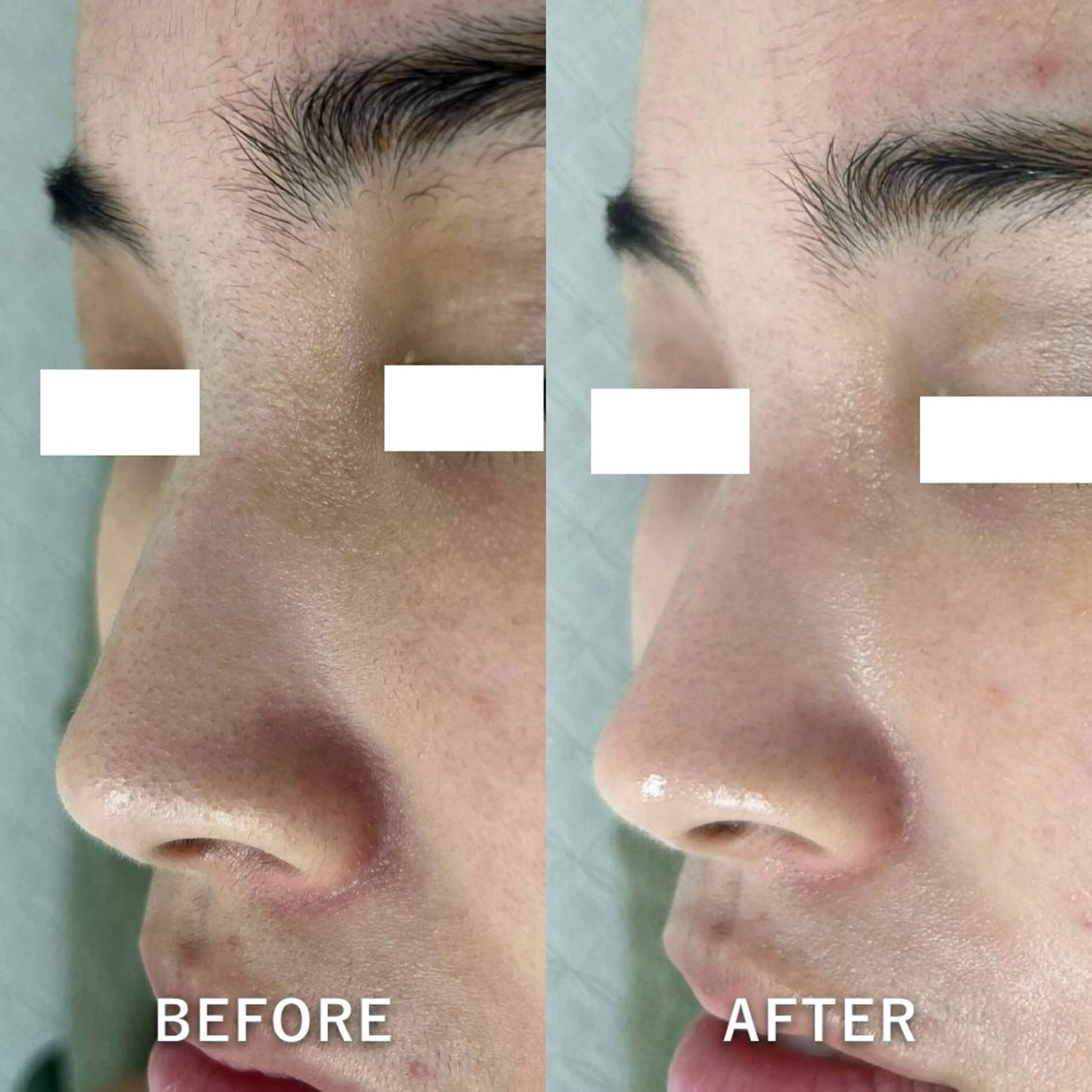 韓国美肌/肌質改善 【天神】yuiのエステ・リラクイメージ