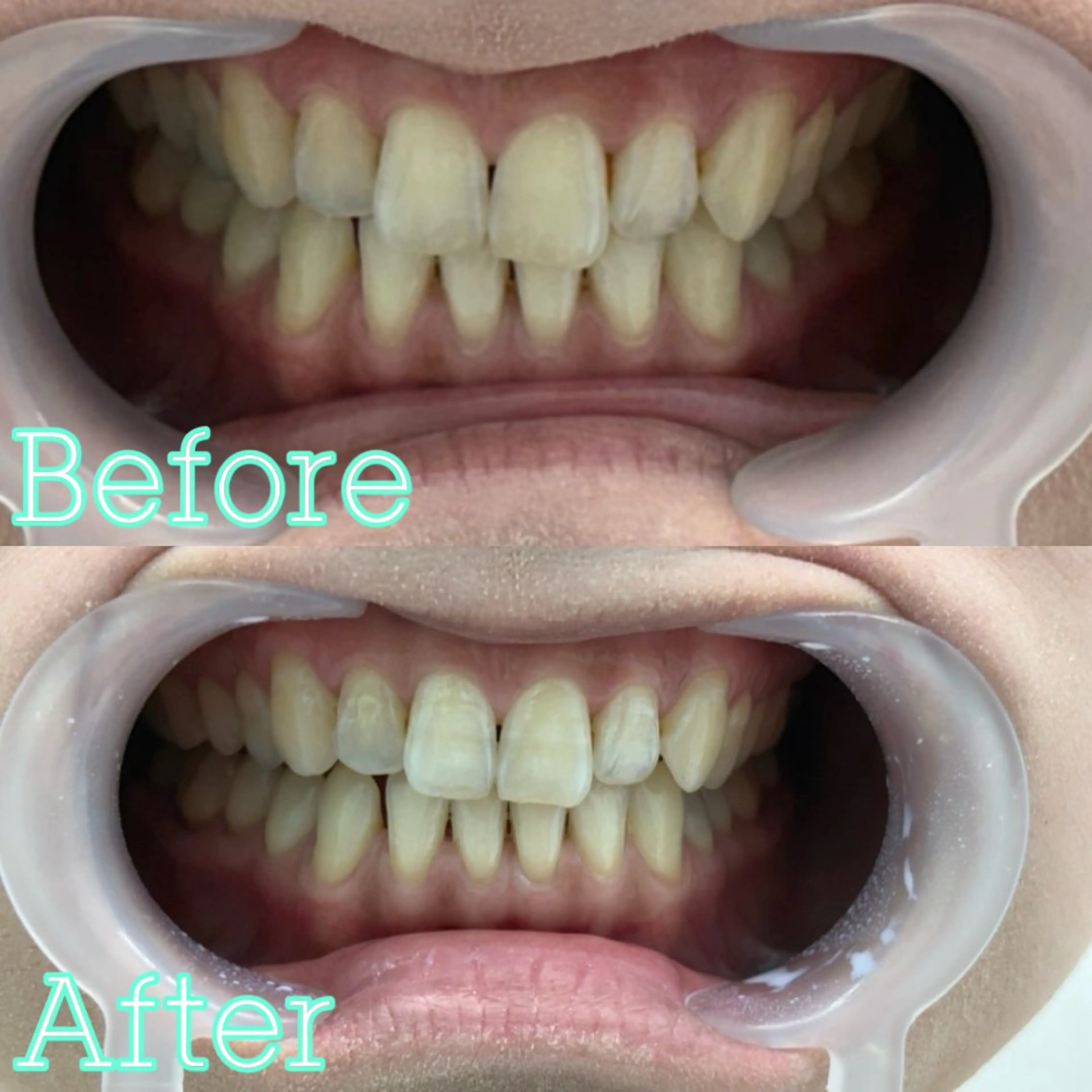 歯のホワイトニング専門店 MIGAQ 京都四条大宮店所属・佐藤 未来の眉毛・アイブロウイメージ