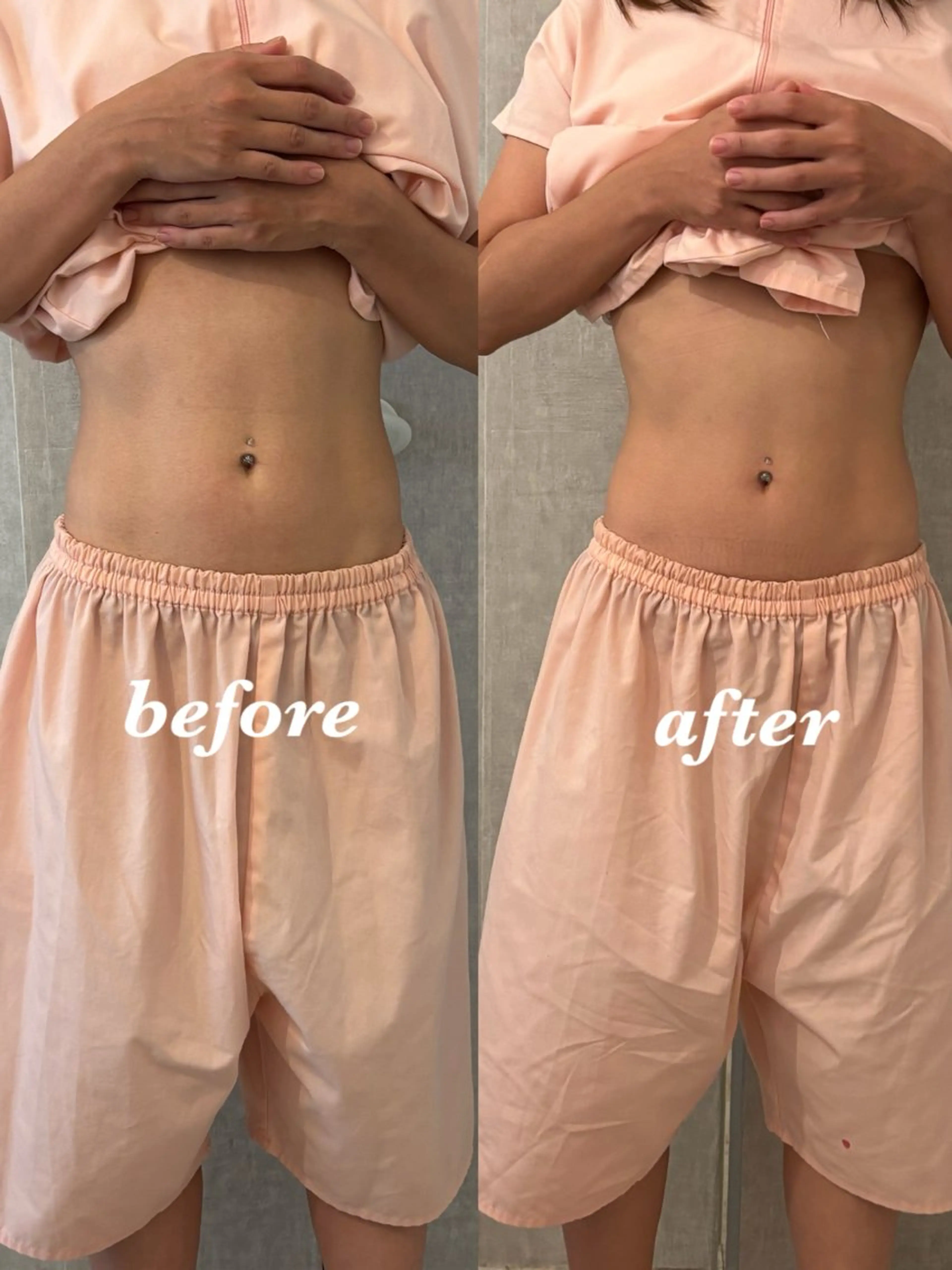 エステ リラク 腸活サポート みなみののエステ・リラクイメージ