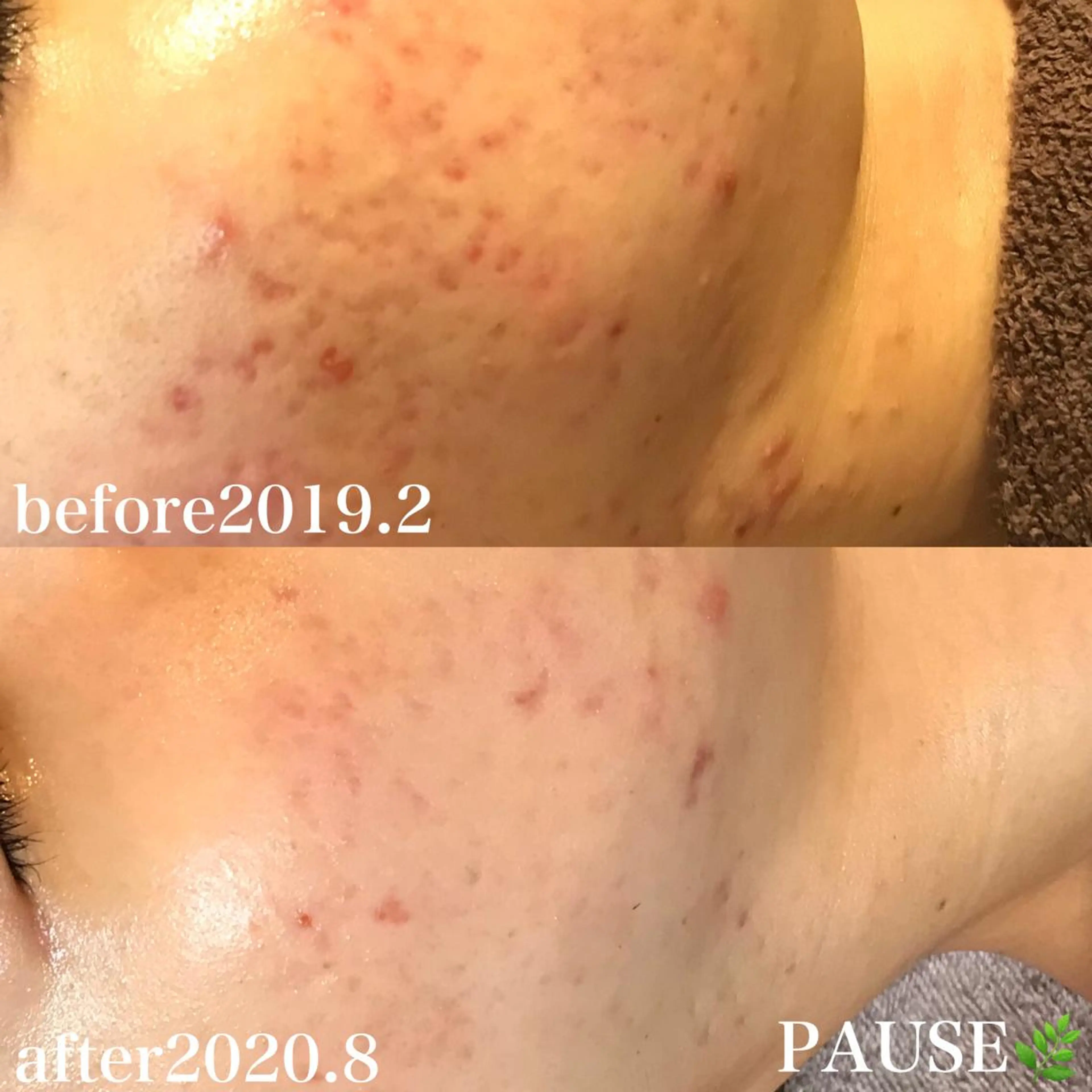 エステ 浜野 恵美のエステ・リラクイメージ