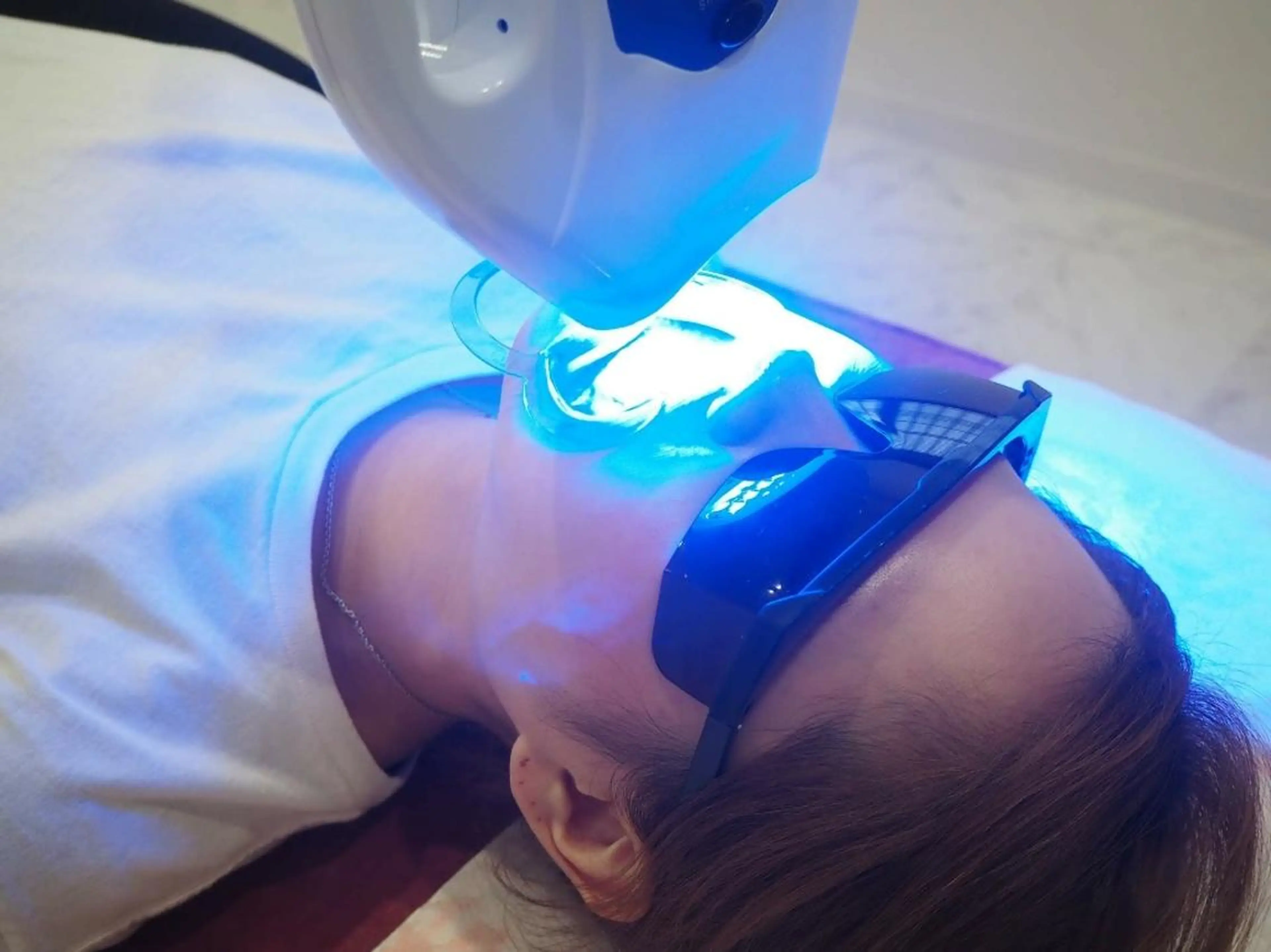 新規初回限定★セルフホワイトニング３回コース★の写真