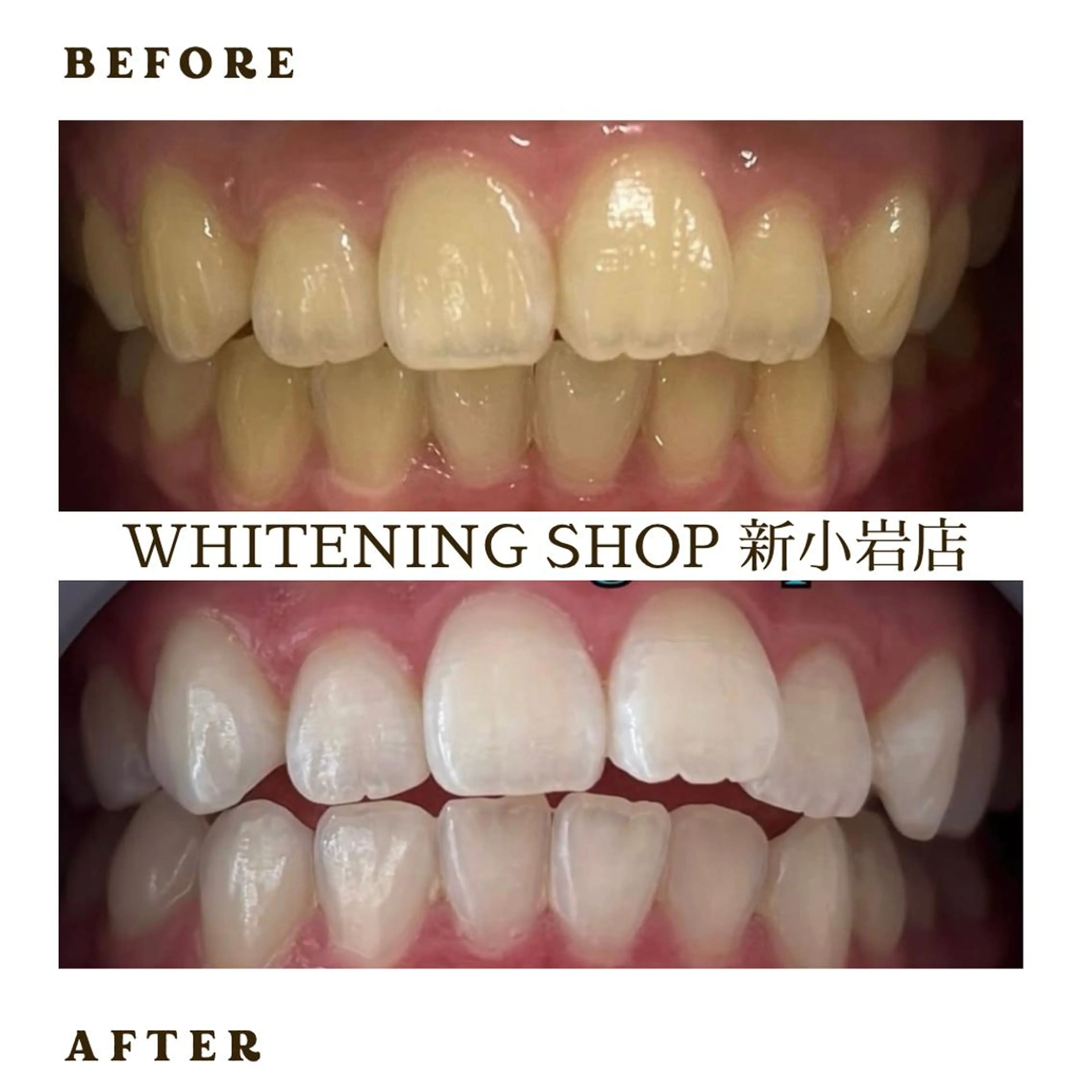 メンズ その他 ホワイトニング ショップ新小岩店のその他イメージ