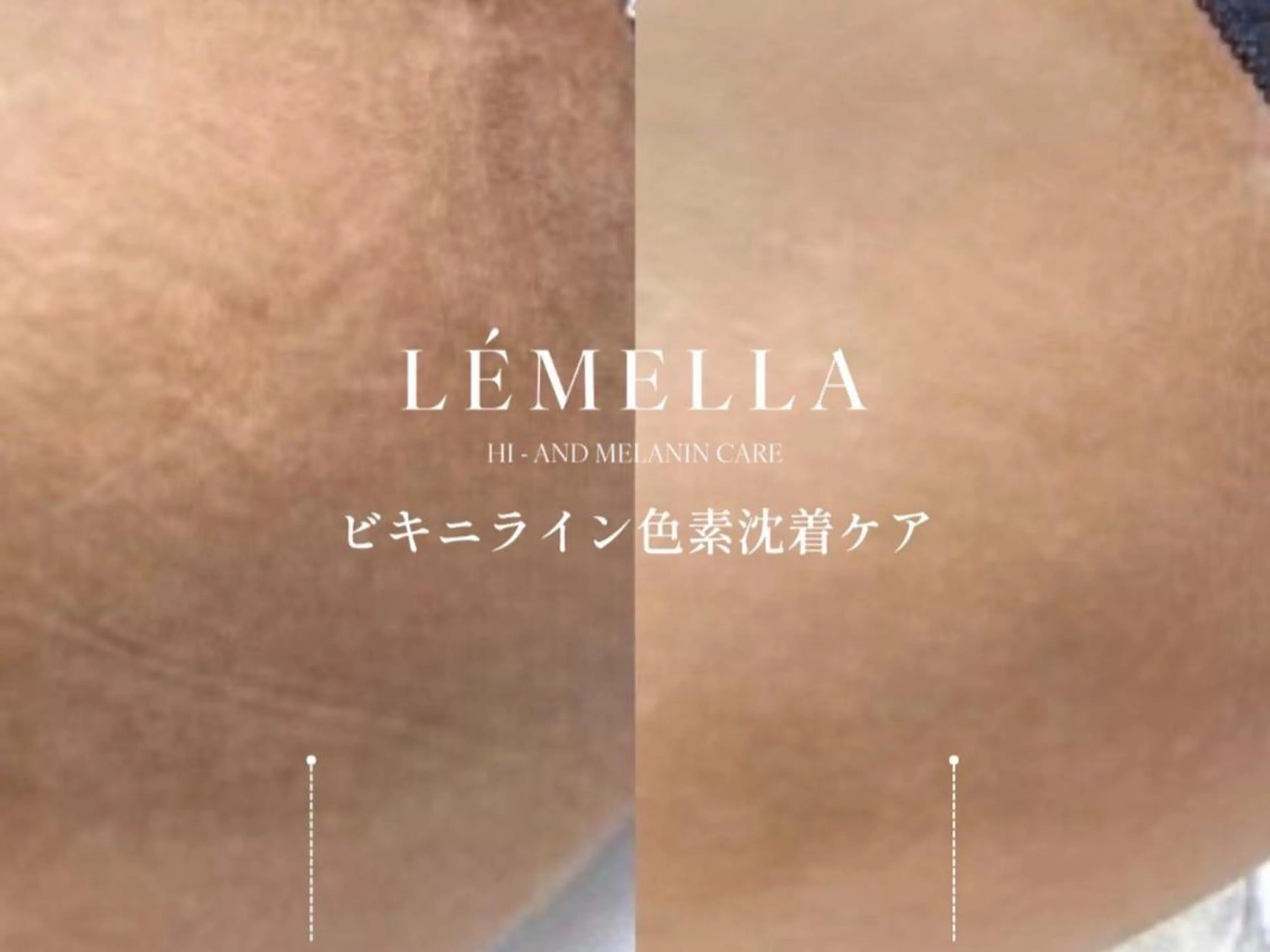 エステ M FLOAT skin salonのエステ・リラクイメージ