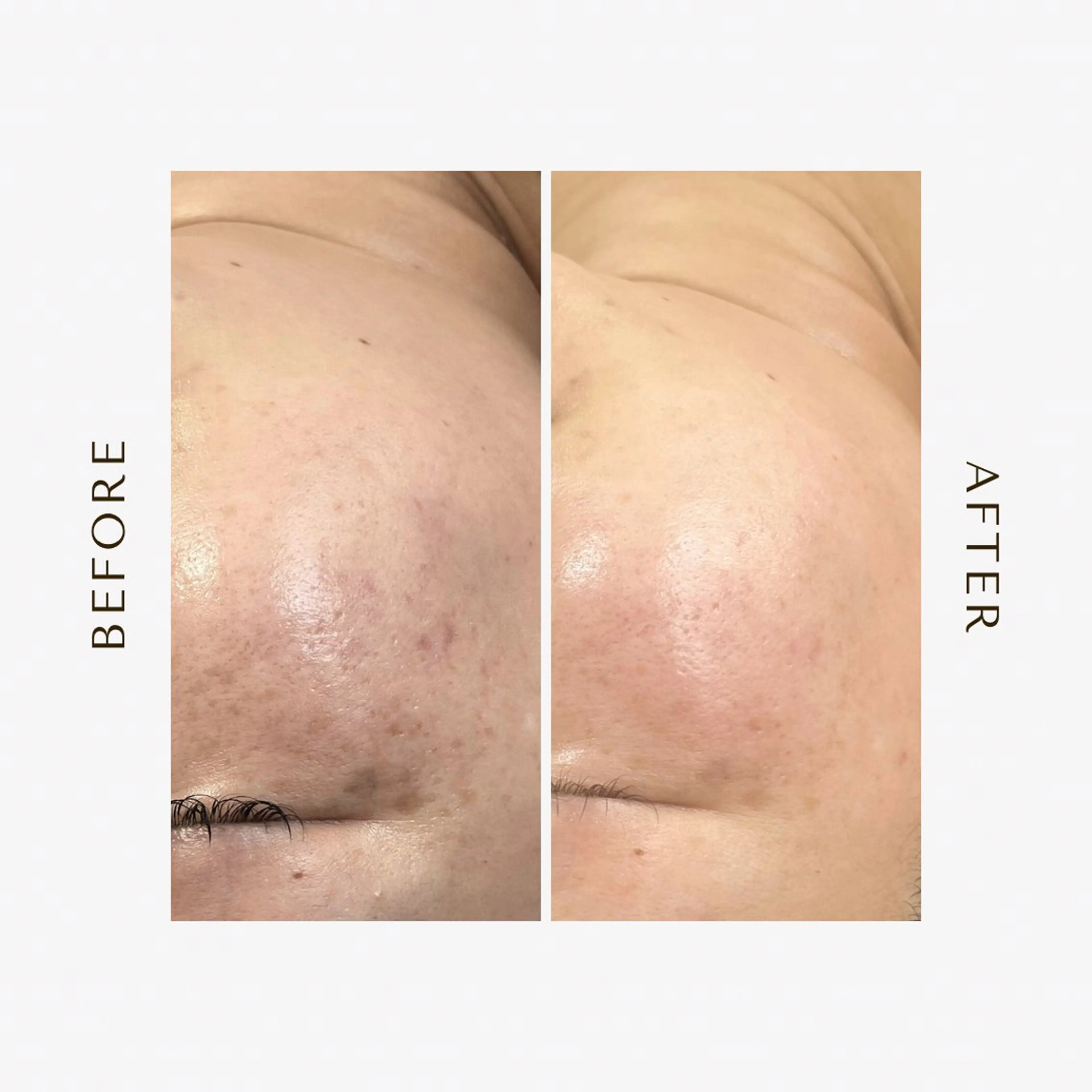 エステ 1st｜フェイシャル エステ専門店のエステ・リラクイメージ