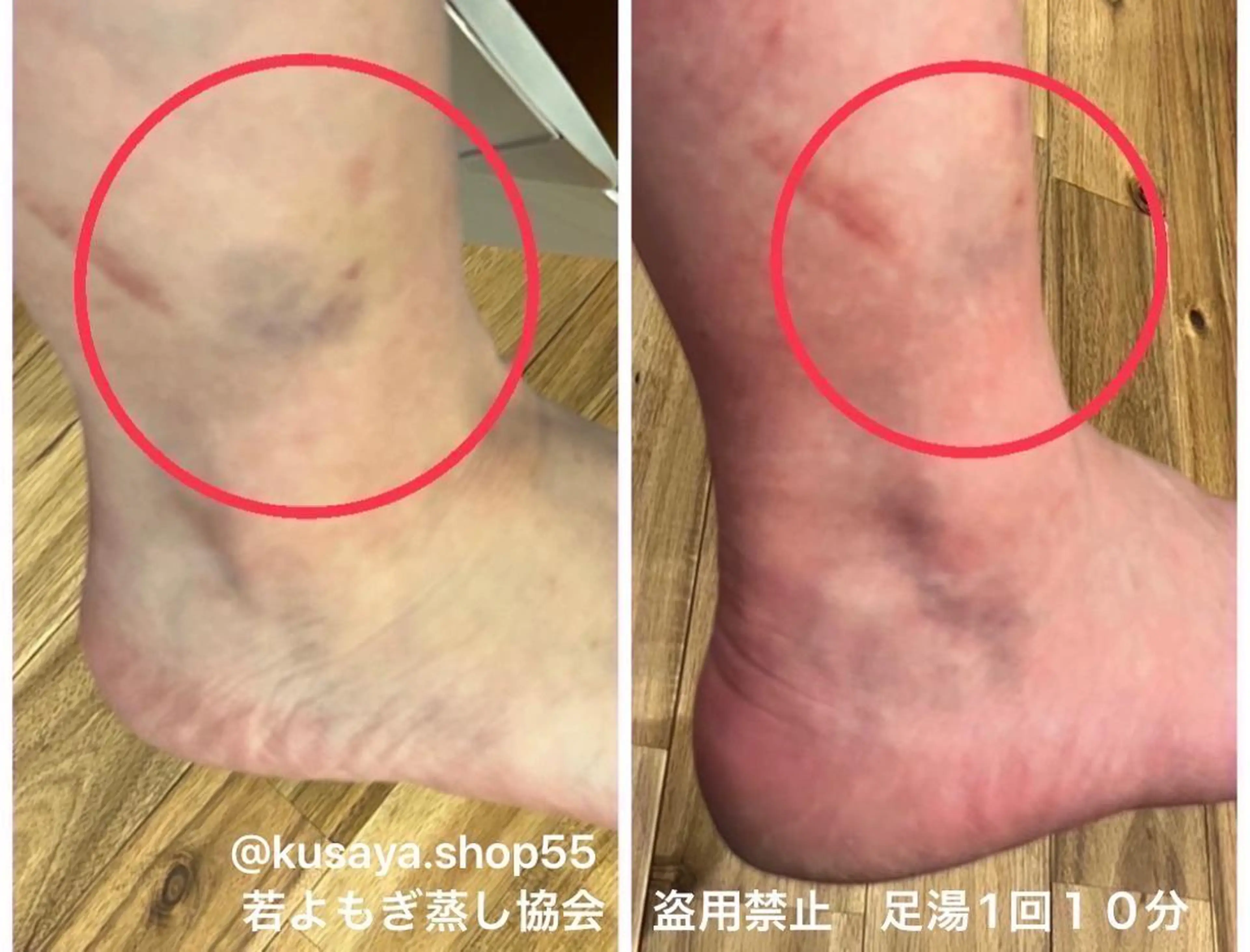 private salon  Dea_maris シュガーリング＆パーソナルボディケア所属・シミ改善・韓国肌管理 ボディメイク痩身のその他イメージ