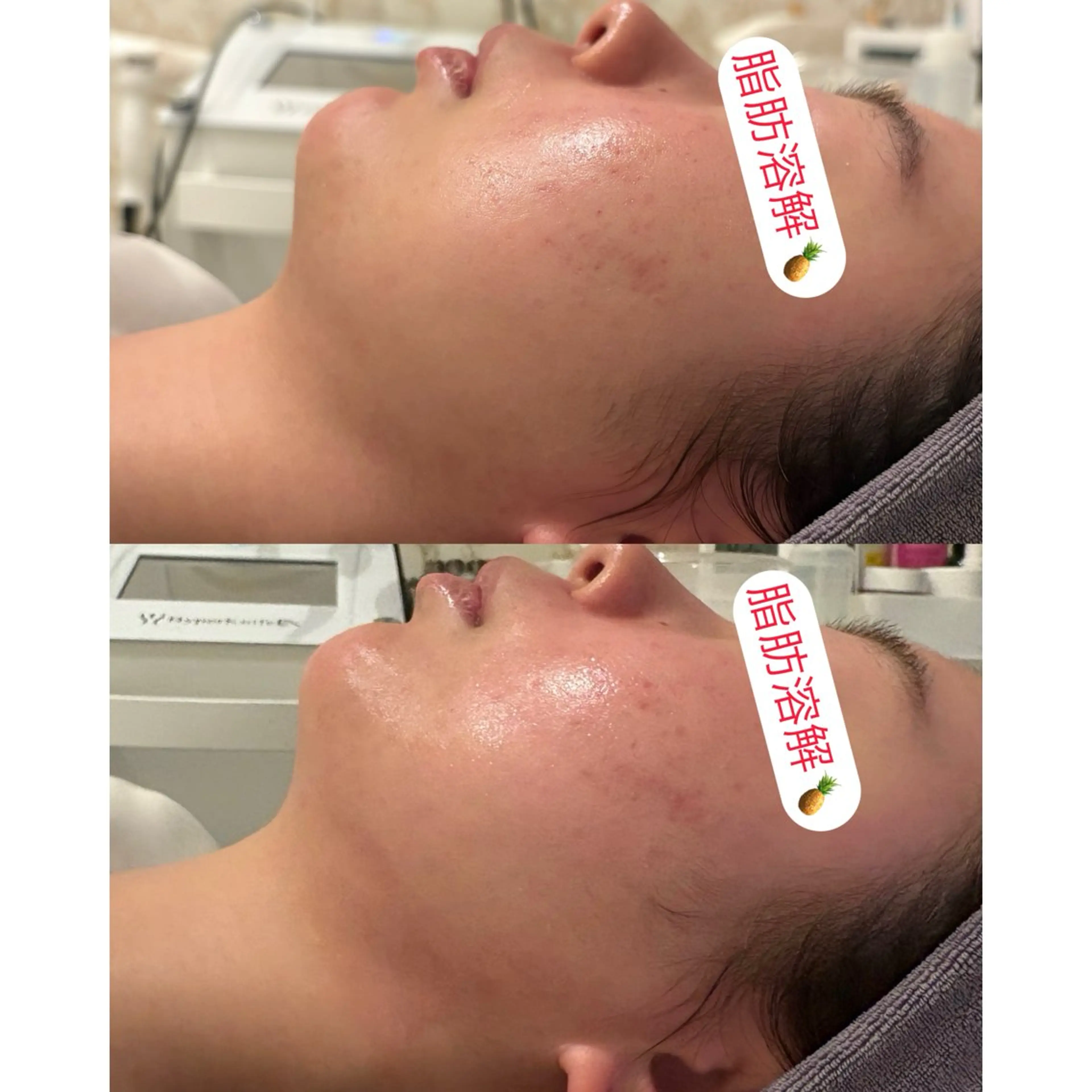 小顔コルギ ☆表参道/外苑前のエステ・リラクイメージ