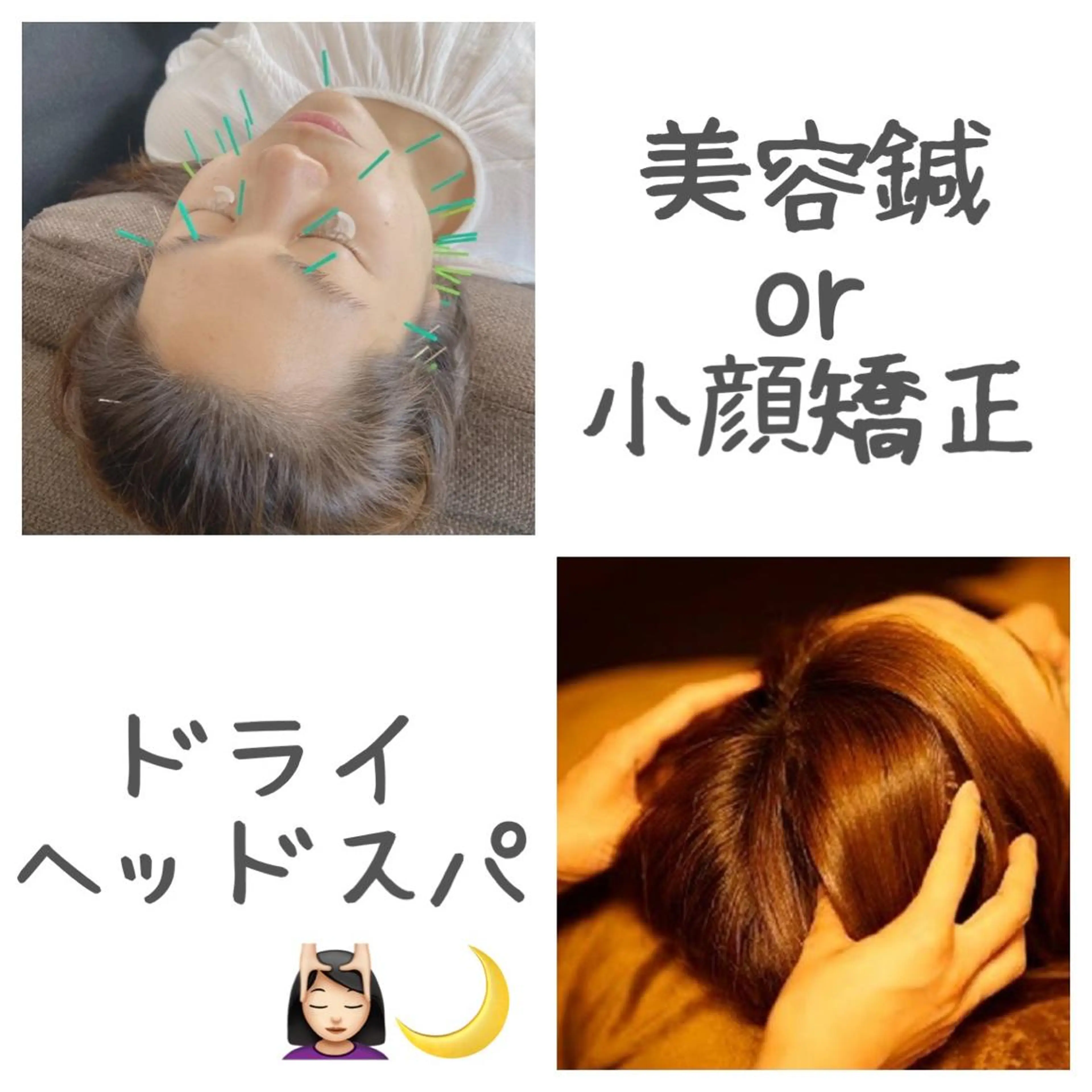 美容鍼or小顔矯正+ヘッドマッサージ💆🏻♀️🌙の写真