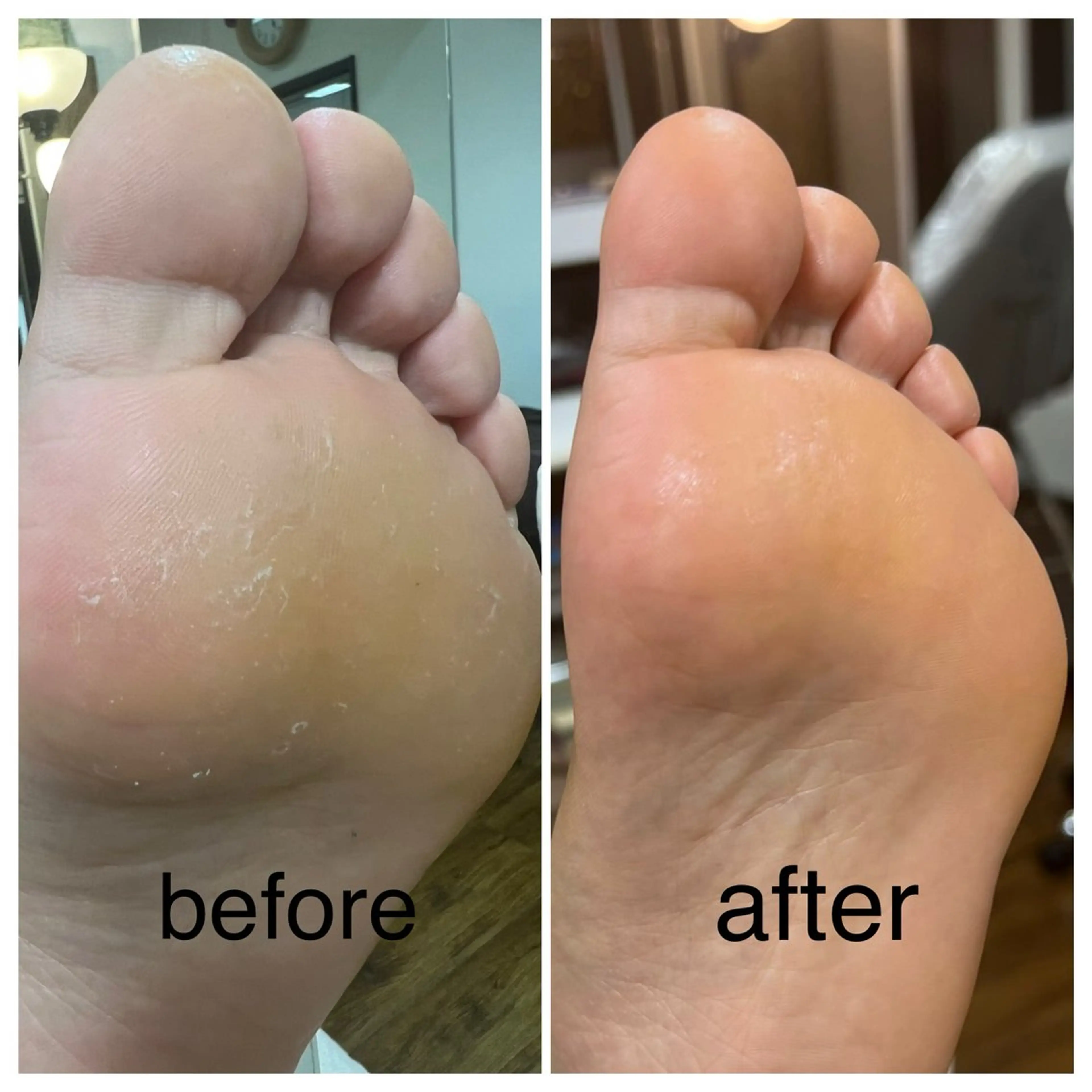 足裏のザラザラ角質削りケア＋本格デトックス足つぼ×オイルリンパマッサージ（足湯付）30分の写真