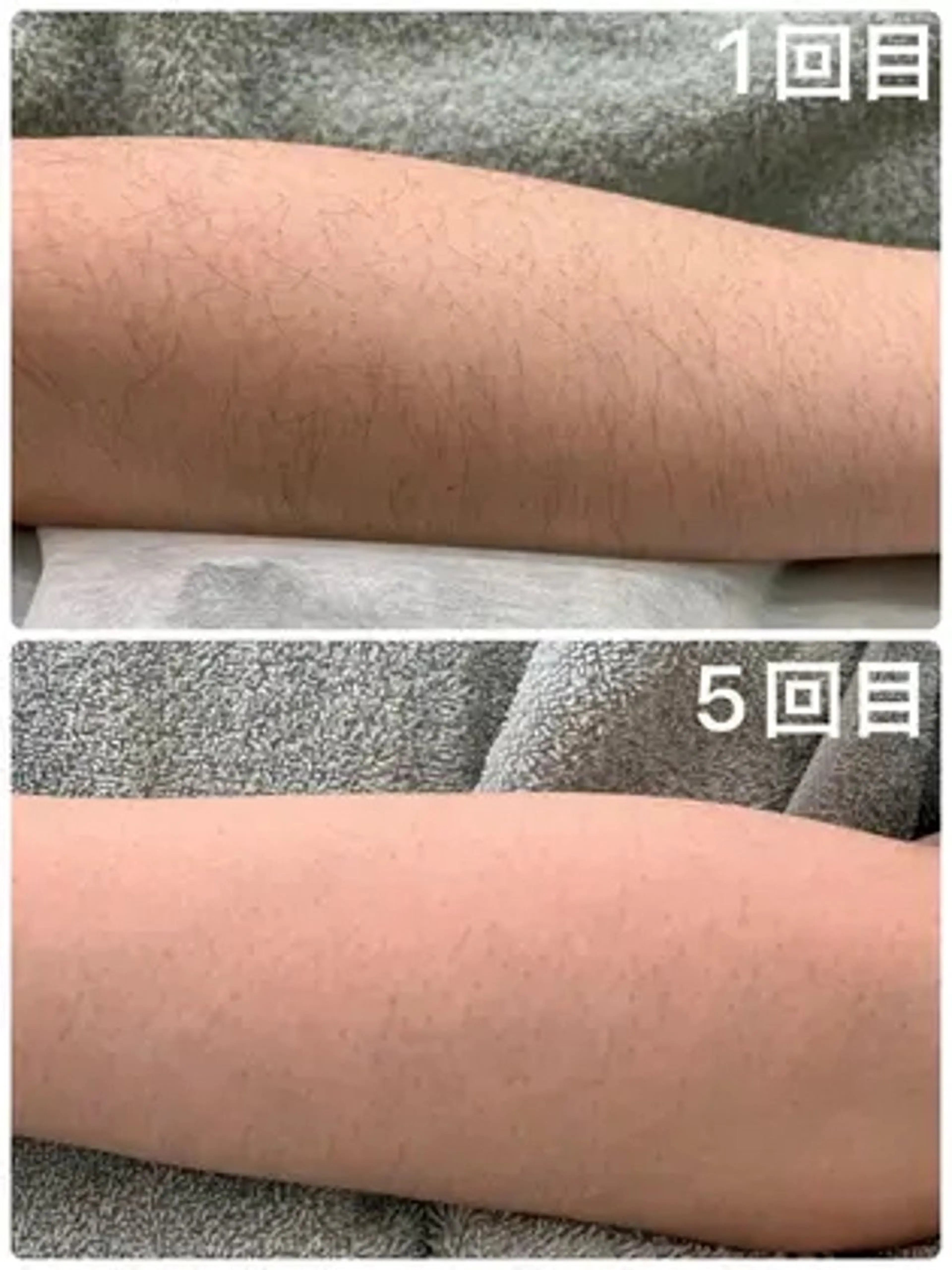 脱毛＆フェイシャル MIEUX心斎橋店のエステ・リラクイメージ