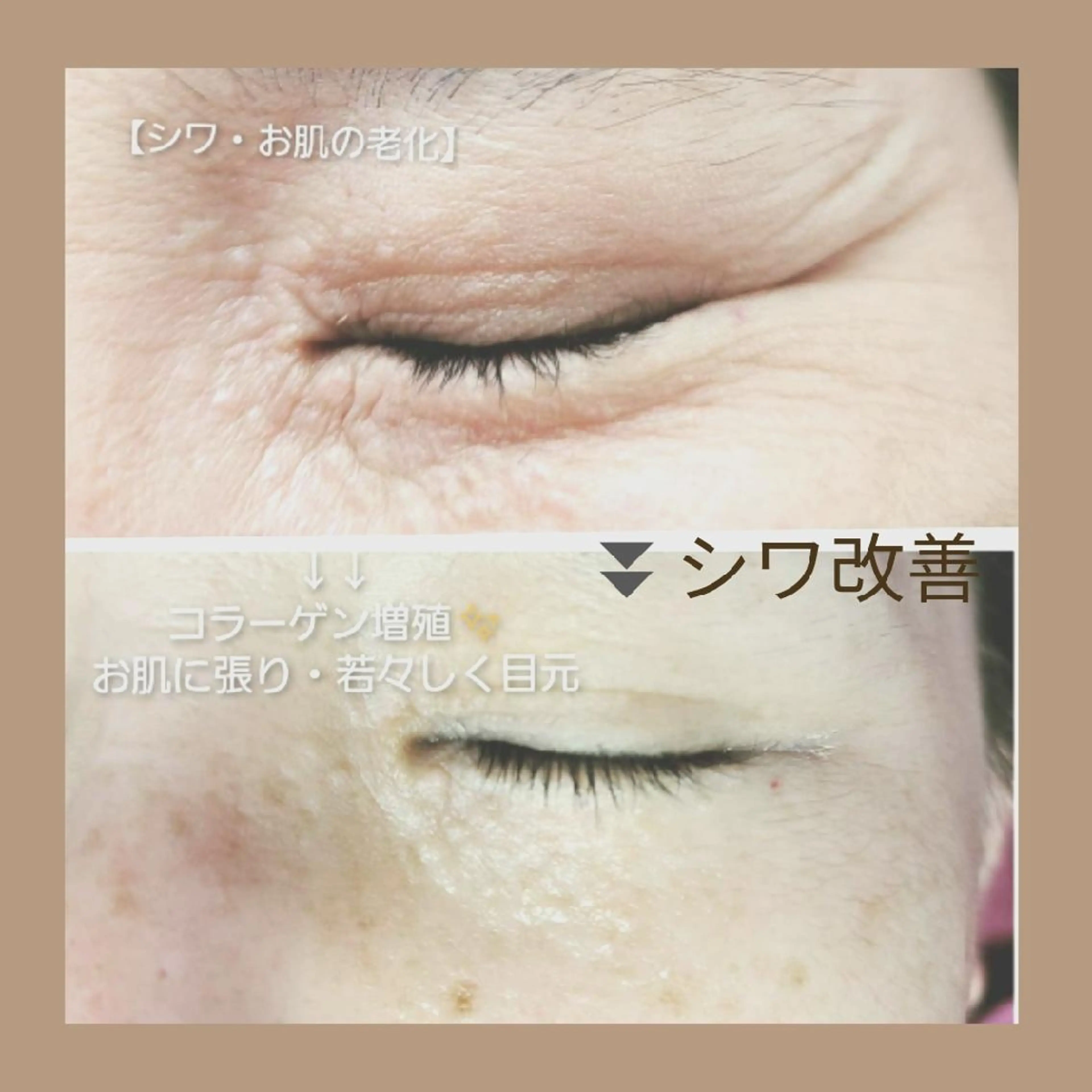 エステ パーソナルカラー・骨格/顔診断【eternity】所属・【トータル美容】 Eternityのその他イメージ