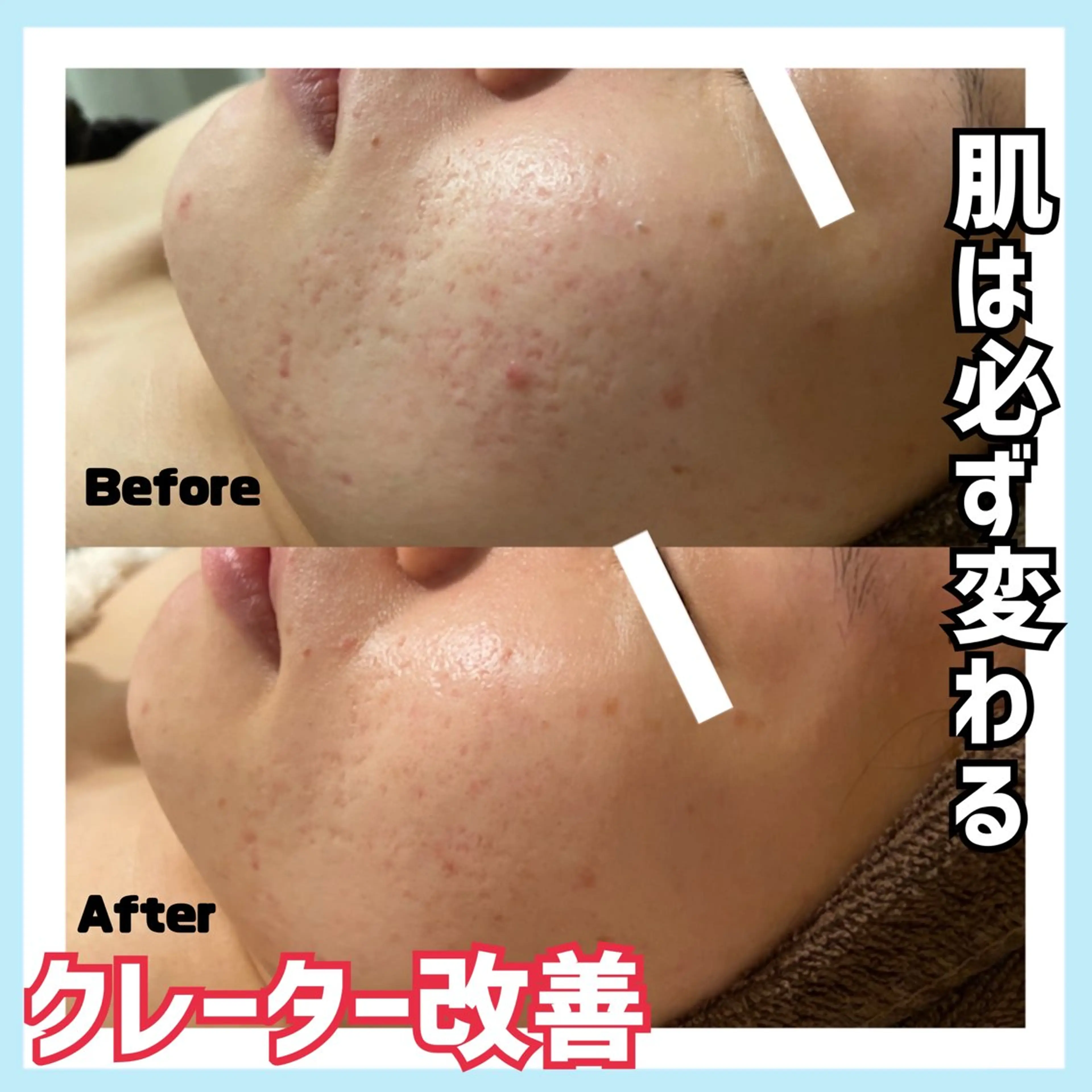 エステ オールハンド専門🤍 kasumiのエステ・リラクイメージ