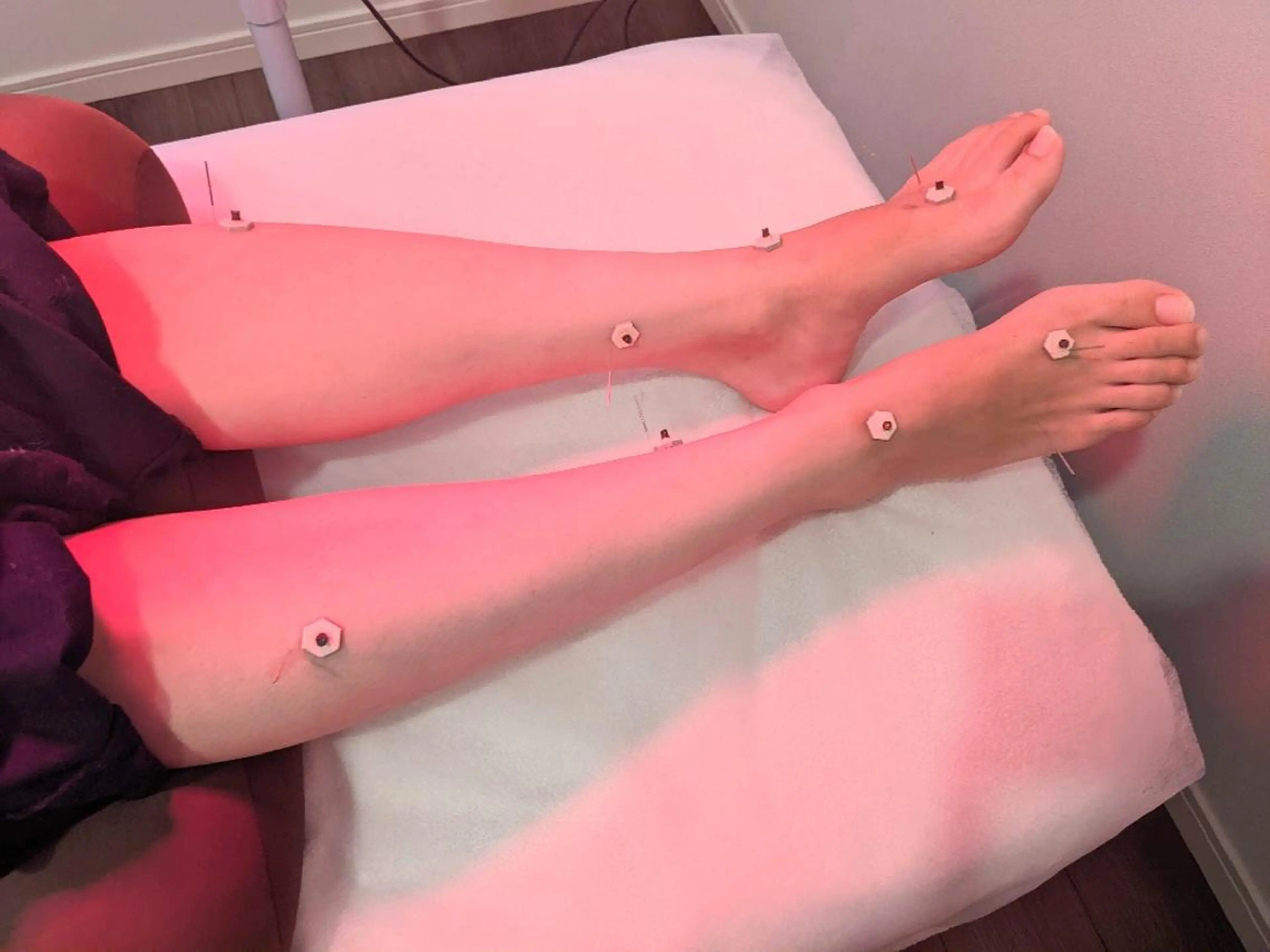 小顔美容鍼灸Acubelle Yakuin.【アキュベル薬院】所属・石川 真梨奈  美容鍼灸/アロマのエステ・リラクイメージ