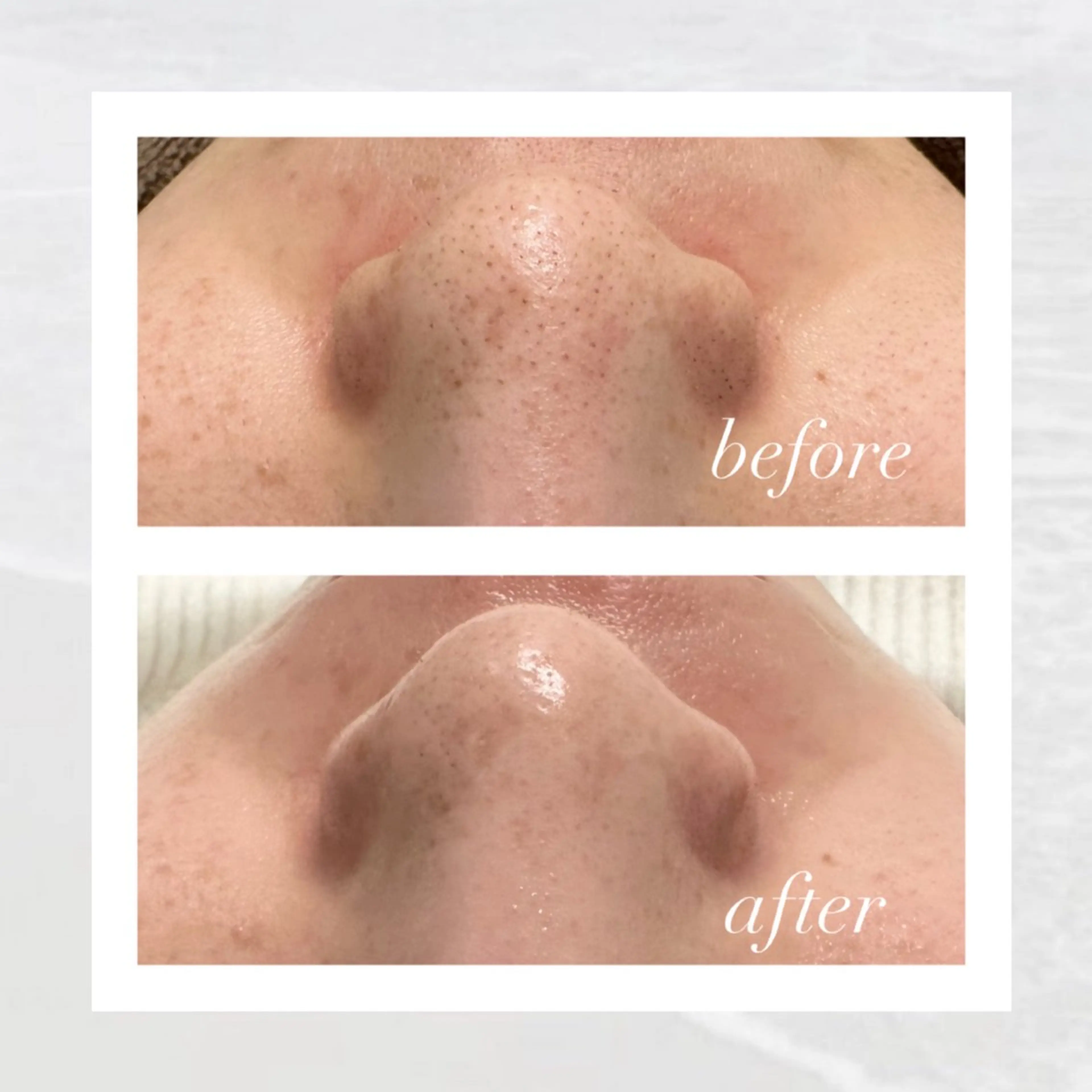 エステ 🦋美肌サロン. maho🦋のエステ・リラクイメージ