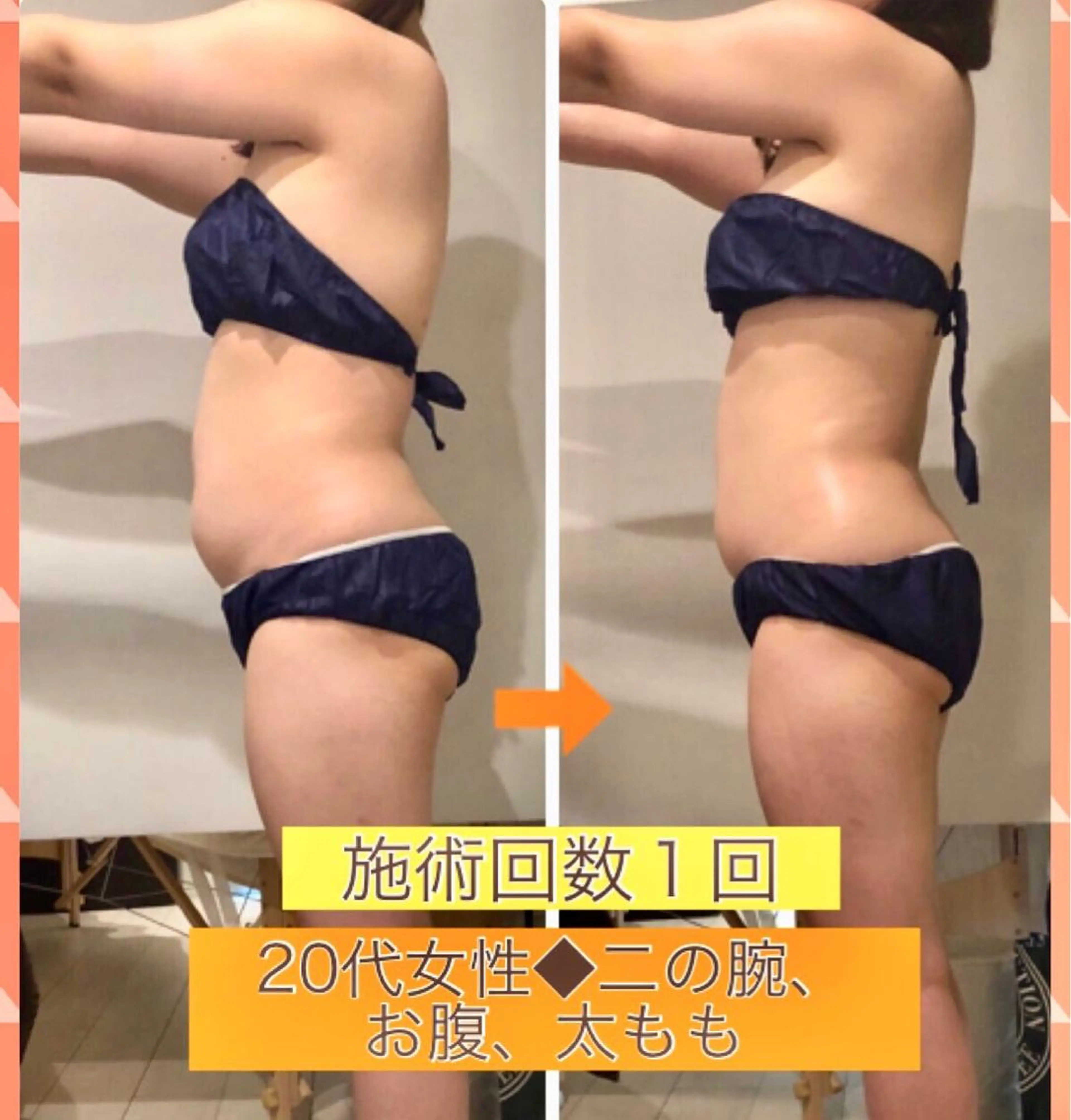 ショート カラー パーマ ヘアアレンジ メンズ キッズ ネイル マツエク・マツパ ‍痩身＆ボディ 結果出し🌟丹野のエステ・リラクイメージ