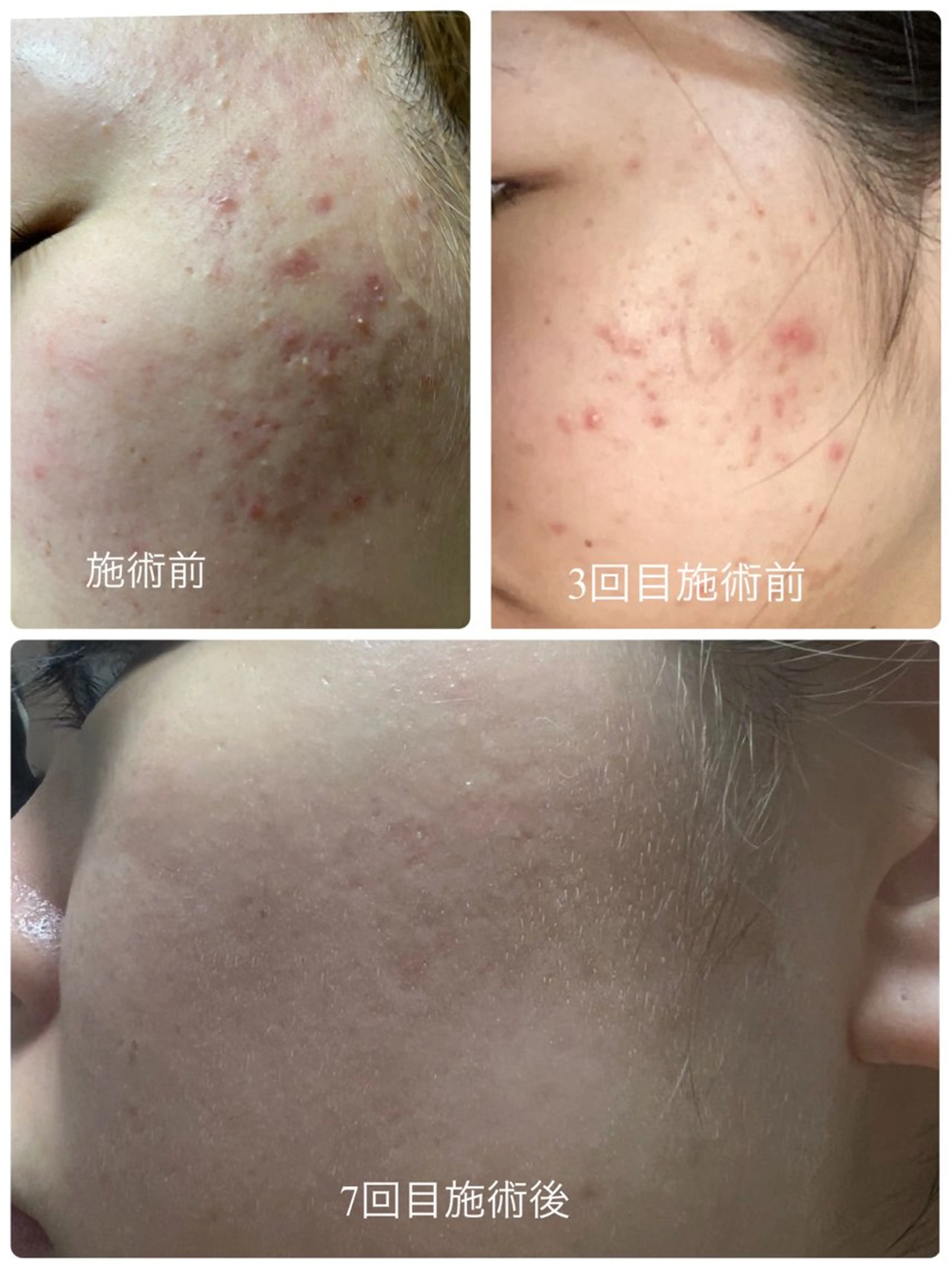 エステ スリーエスプラス内　美肌サロンEme所属・希映 -kieのエステ・リラクイメージ