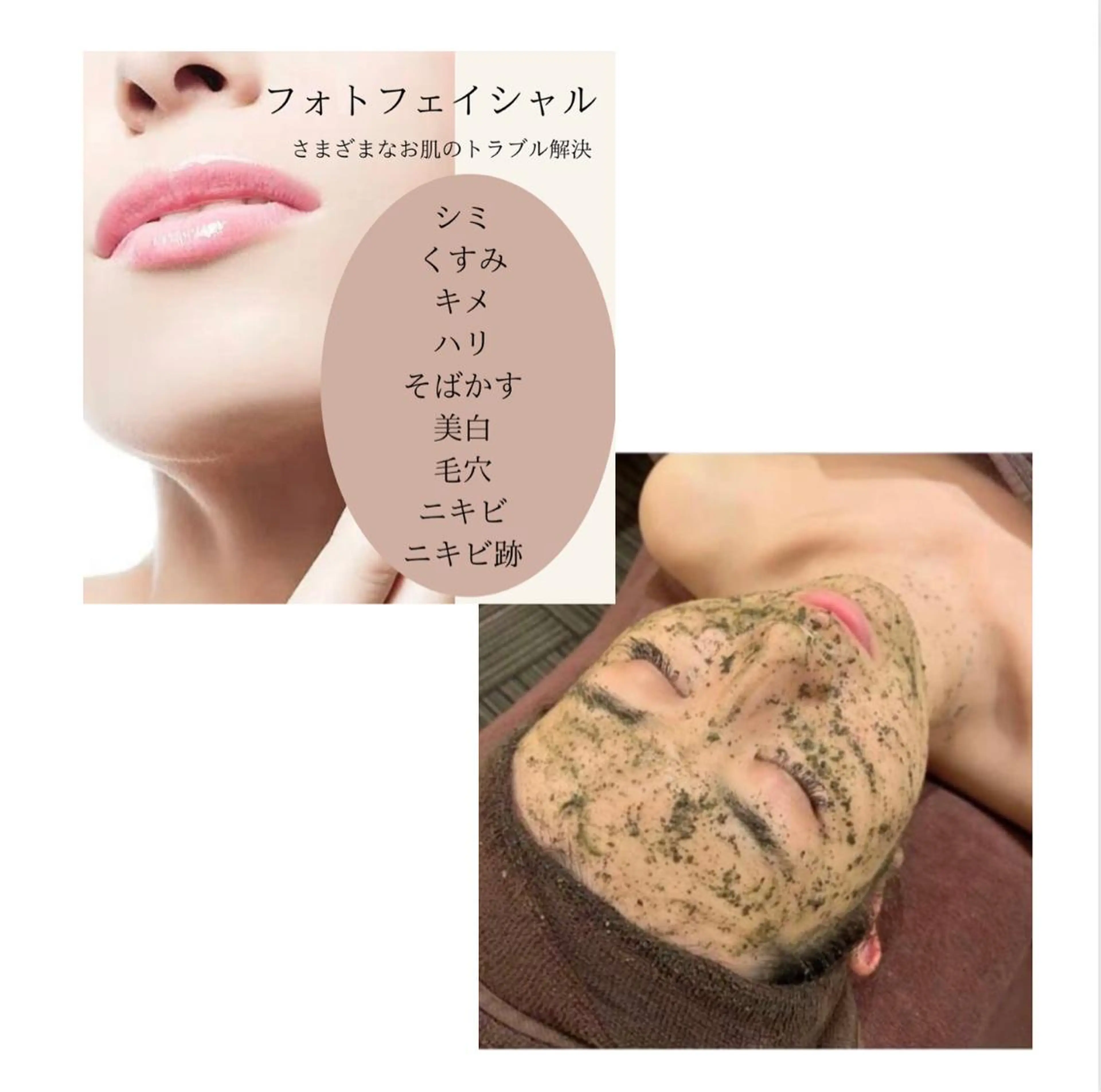 Lumiere despoir所属・Lumiere despoirのエステ・リラクイメージ