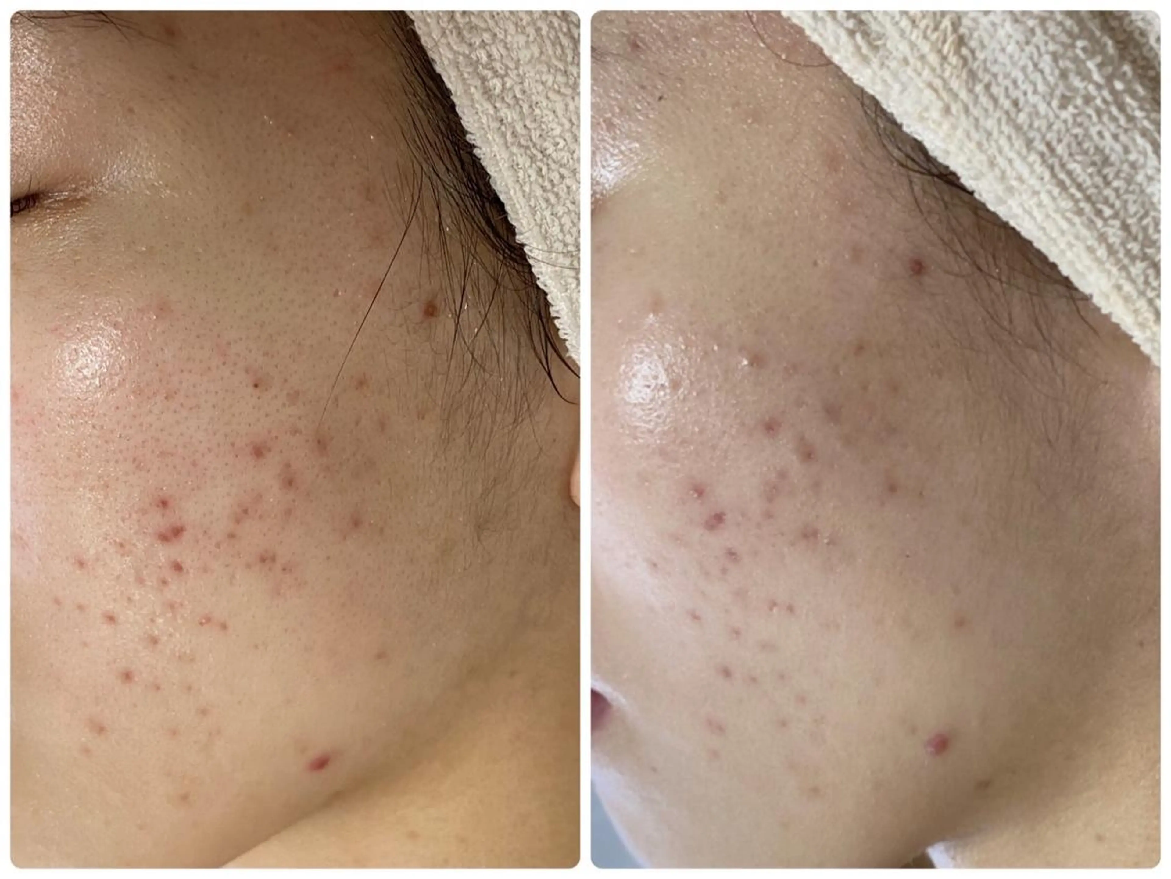 エステ De I'm トータルビューティーサロン所属・COCO beautyサロンのエステ・リラクイメージ