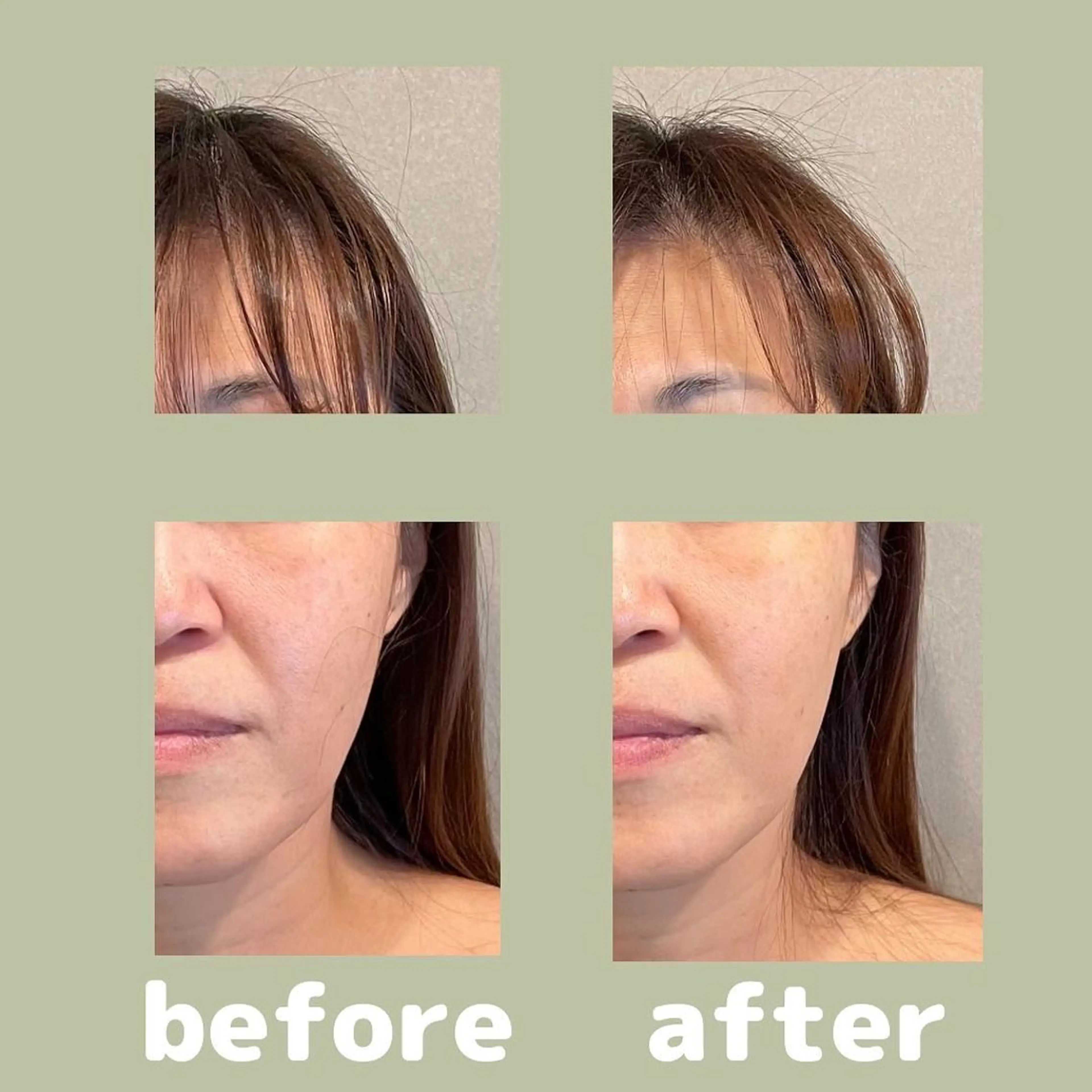 美容鍼灸サロン      APLUS所属・美容鍼灸サロン APLUSのエステ・リラクイメージ