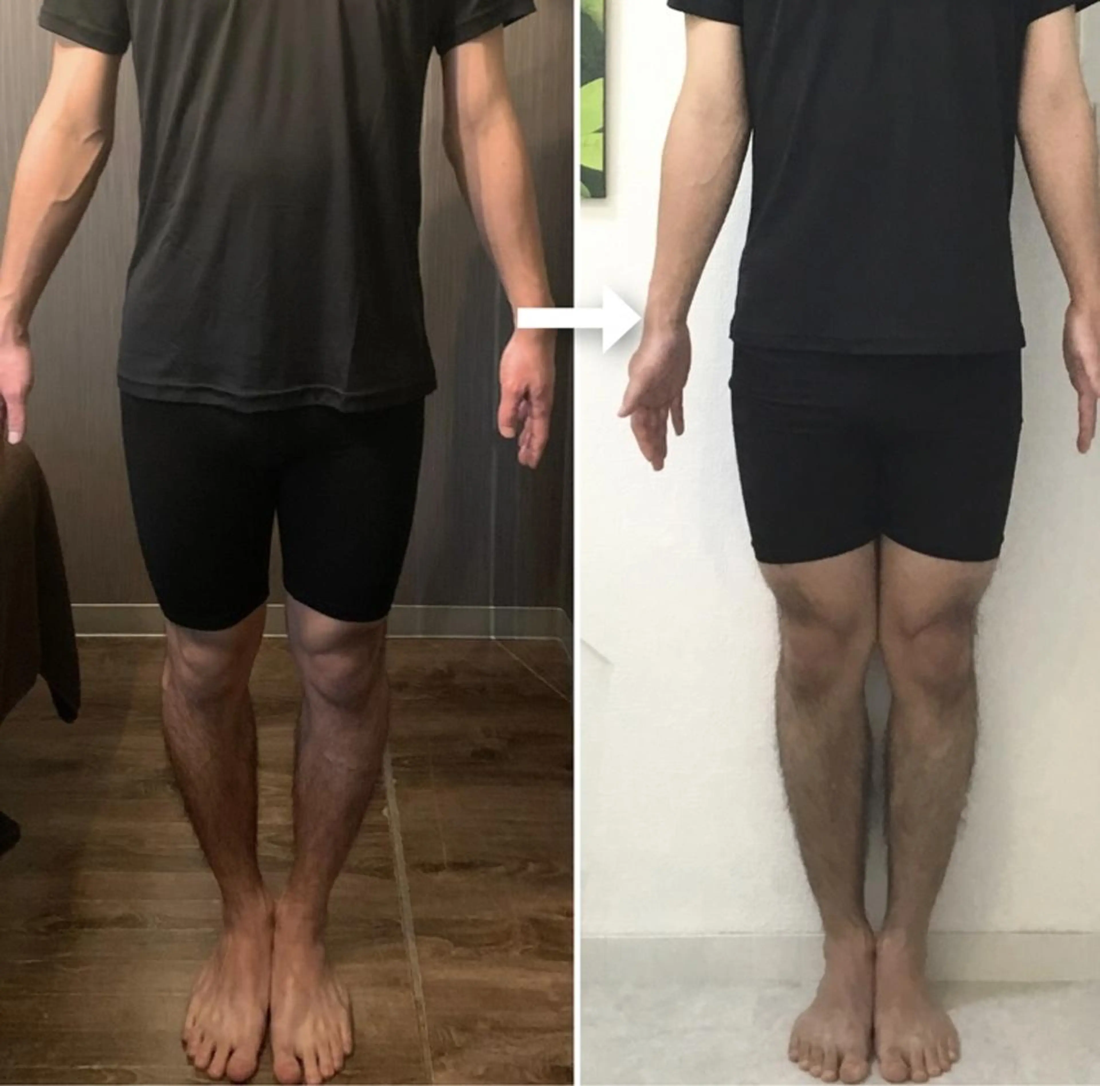 新規男性限定⭐自分史上最高のモテ小顔に✨美ボディもデザイン❗O脚/X脚/クマ【首肩小顔矯正＋頭蓋骨矯正＋骨盤矯正】90分の写真