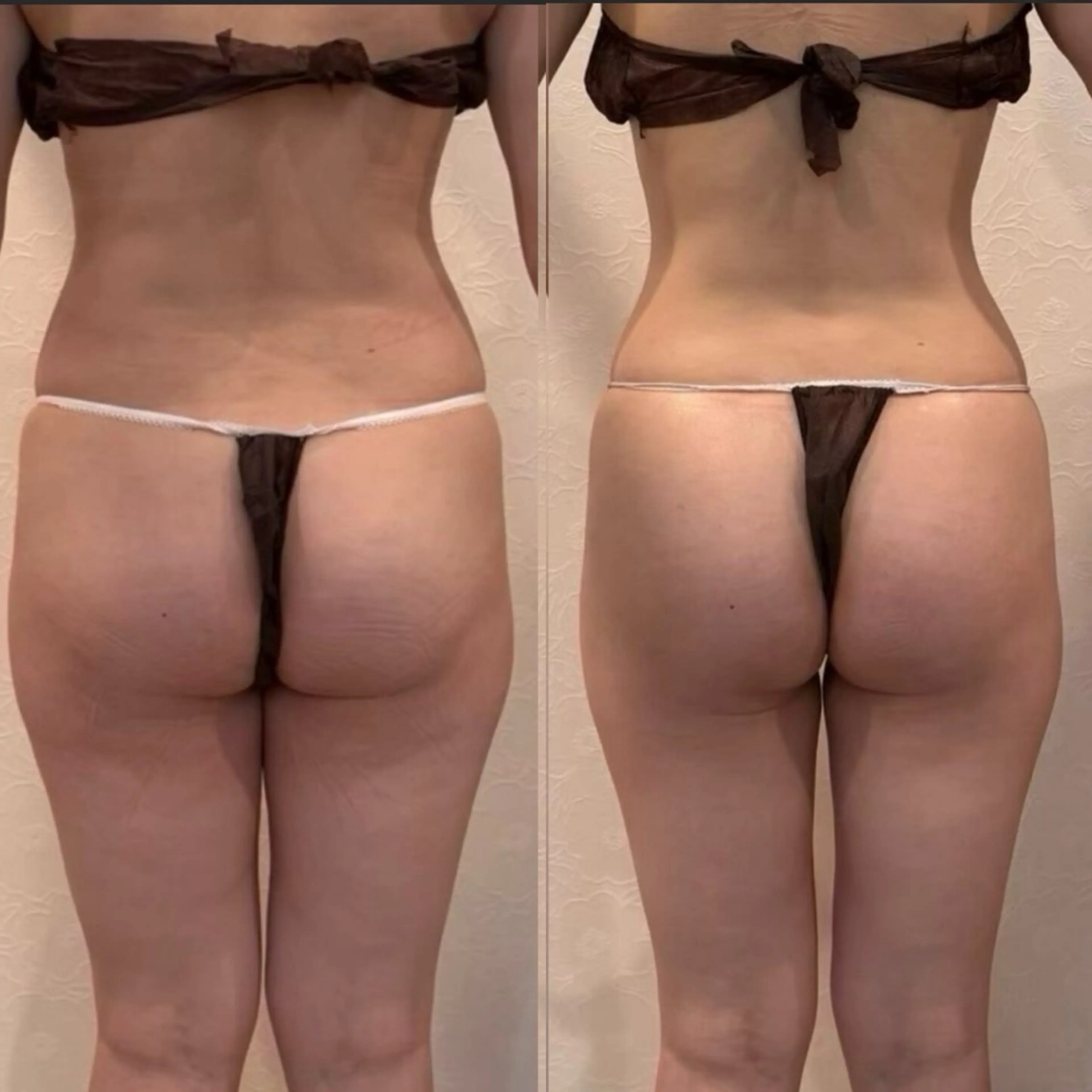 エステ Re:Oasis所属・🦋Re:Oasis 近藤美貴【四谷】🦋のエステ・リラクイメージ