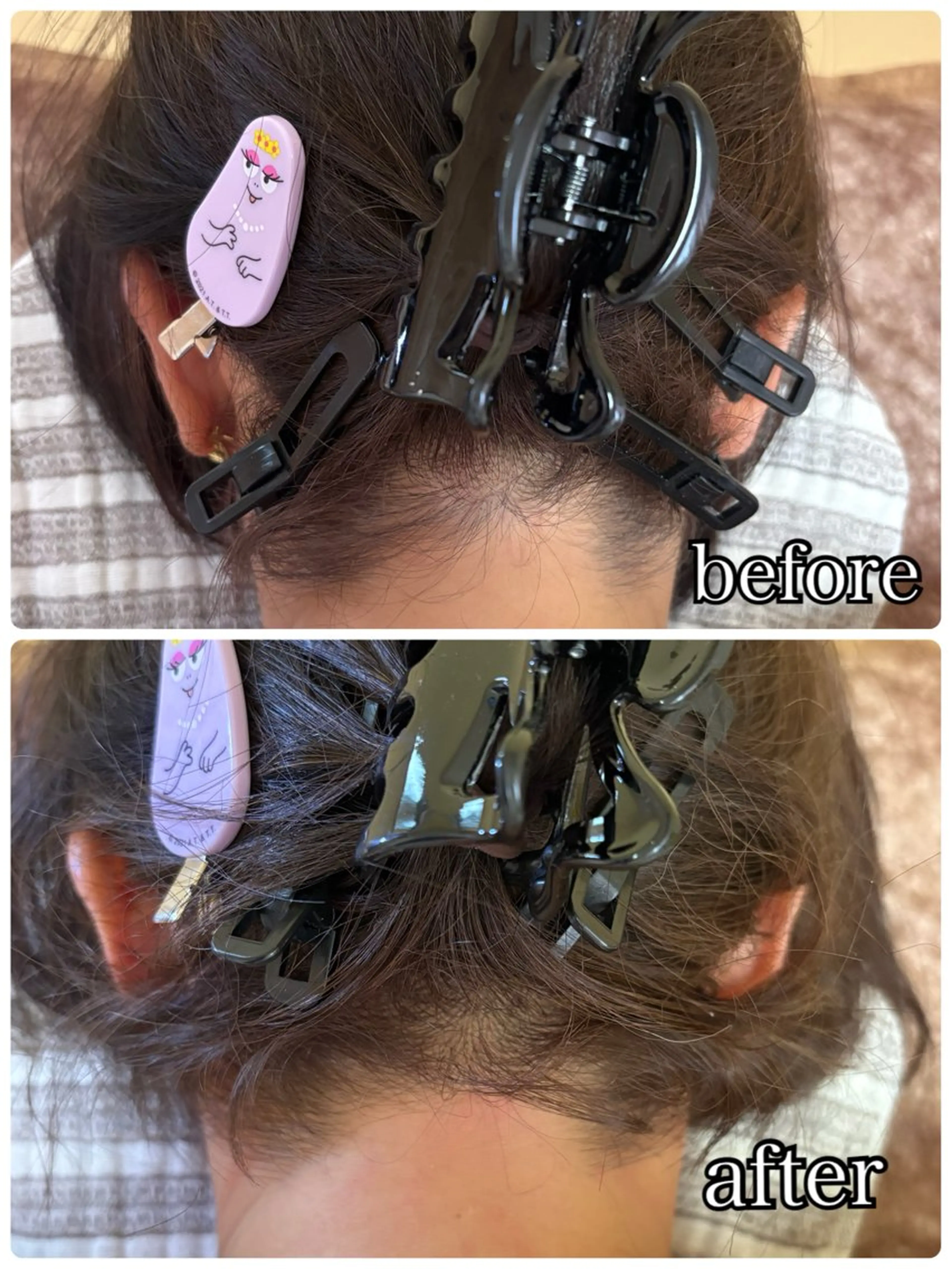 うなじ脱毛🍋シュガーリングの写真