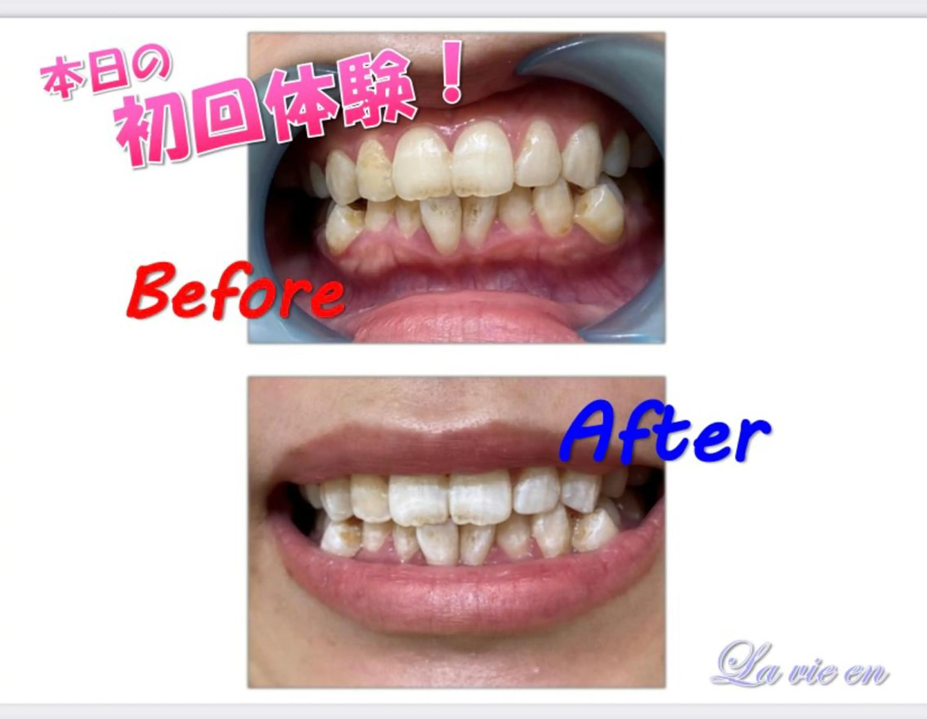 その他 セルフホワイトニングサロン　ラヴィアン所属・ホワイトニングサロン La vie enのその他イメージ