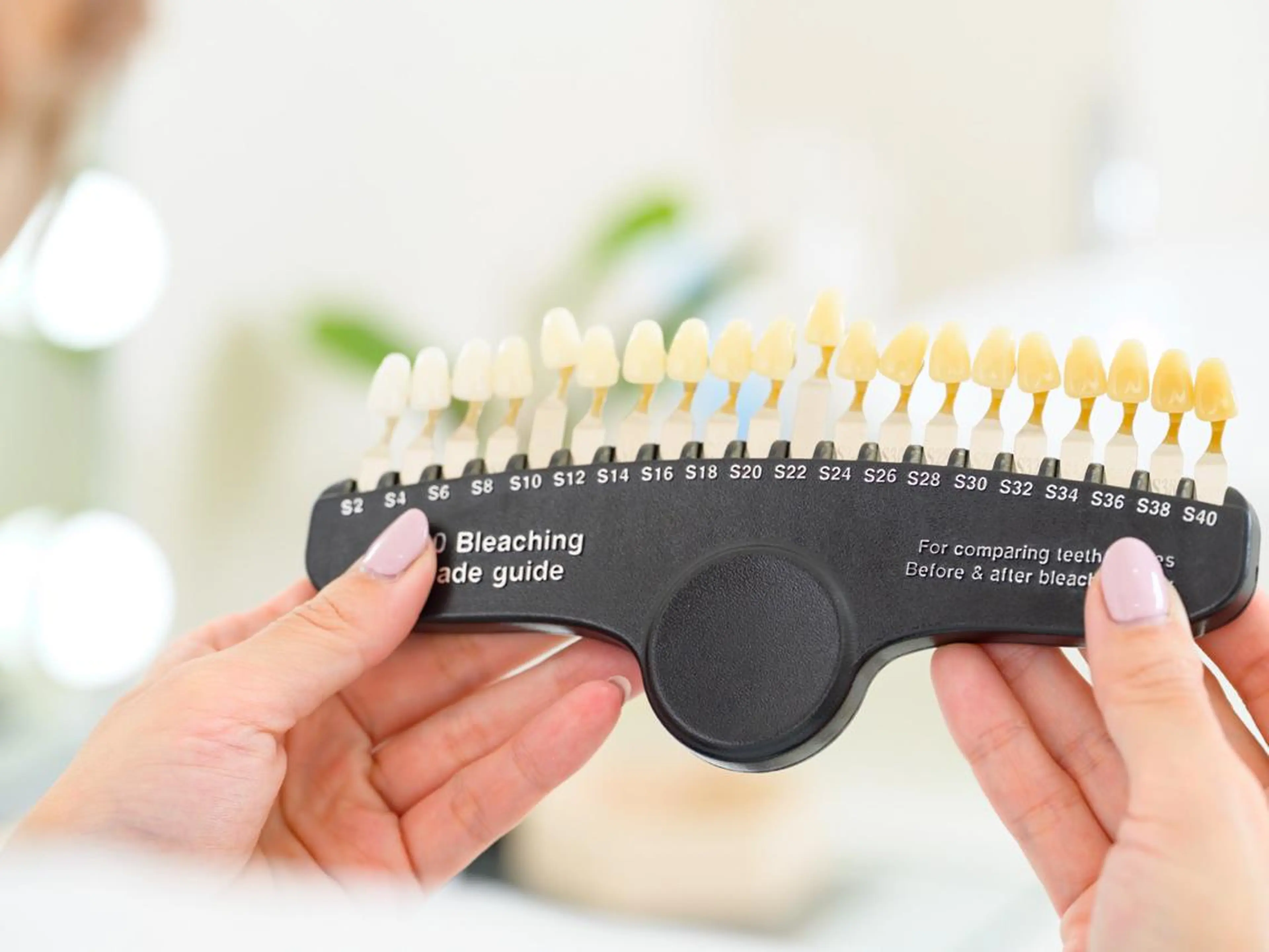 ホワイトニングビューティー松戸店所属・ホワイトニング ビューティー松戸店のその他イメージ