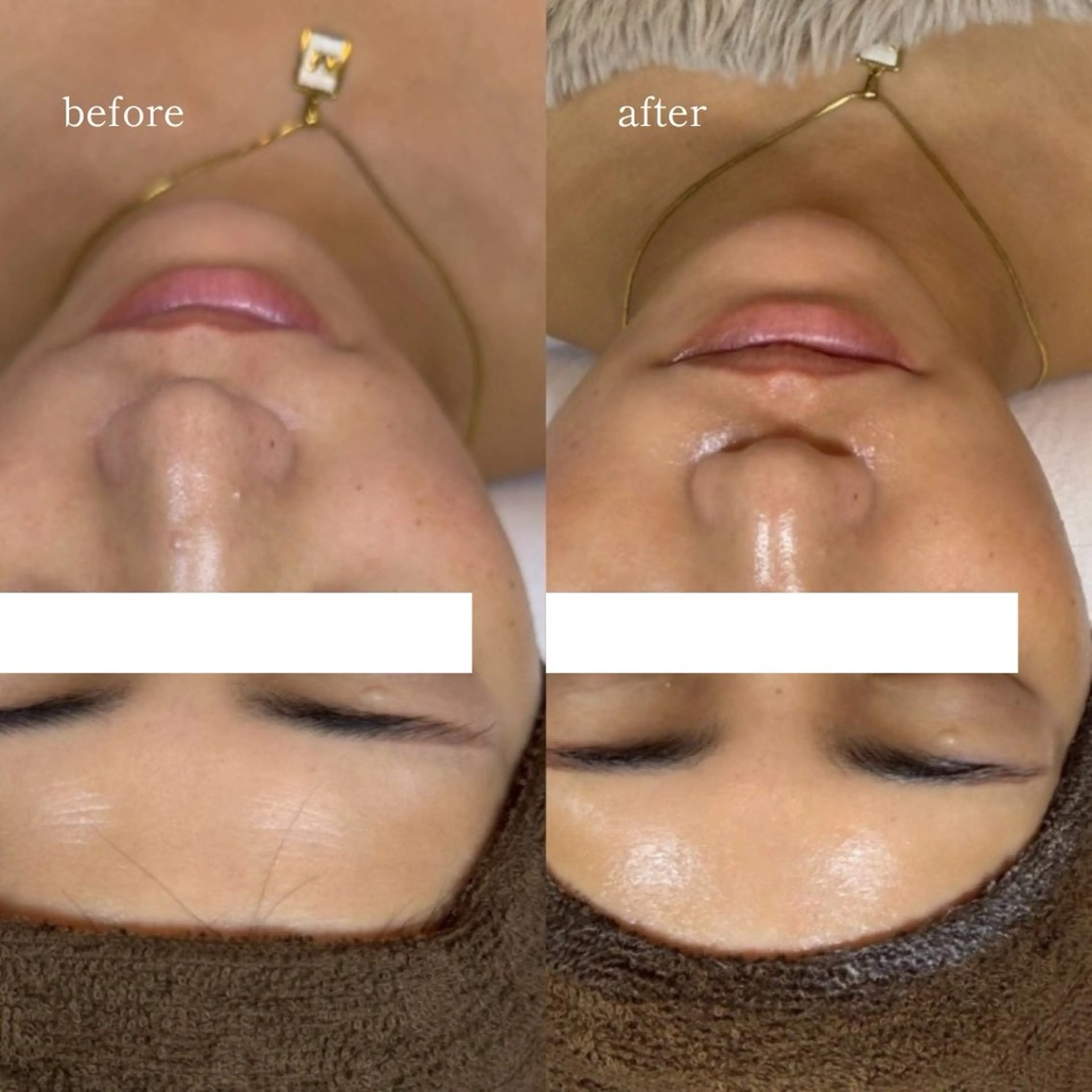 エステ 【韓国人肌製作所】 水光肌ならアーネストのエステ・リラクイメージ