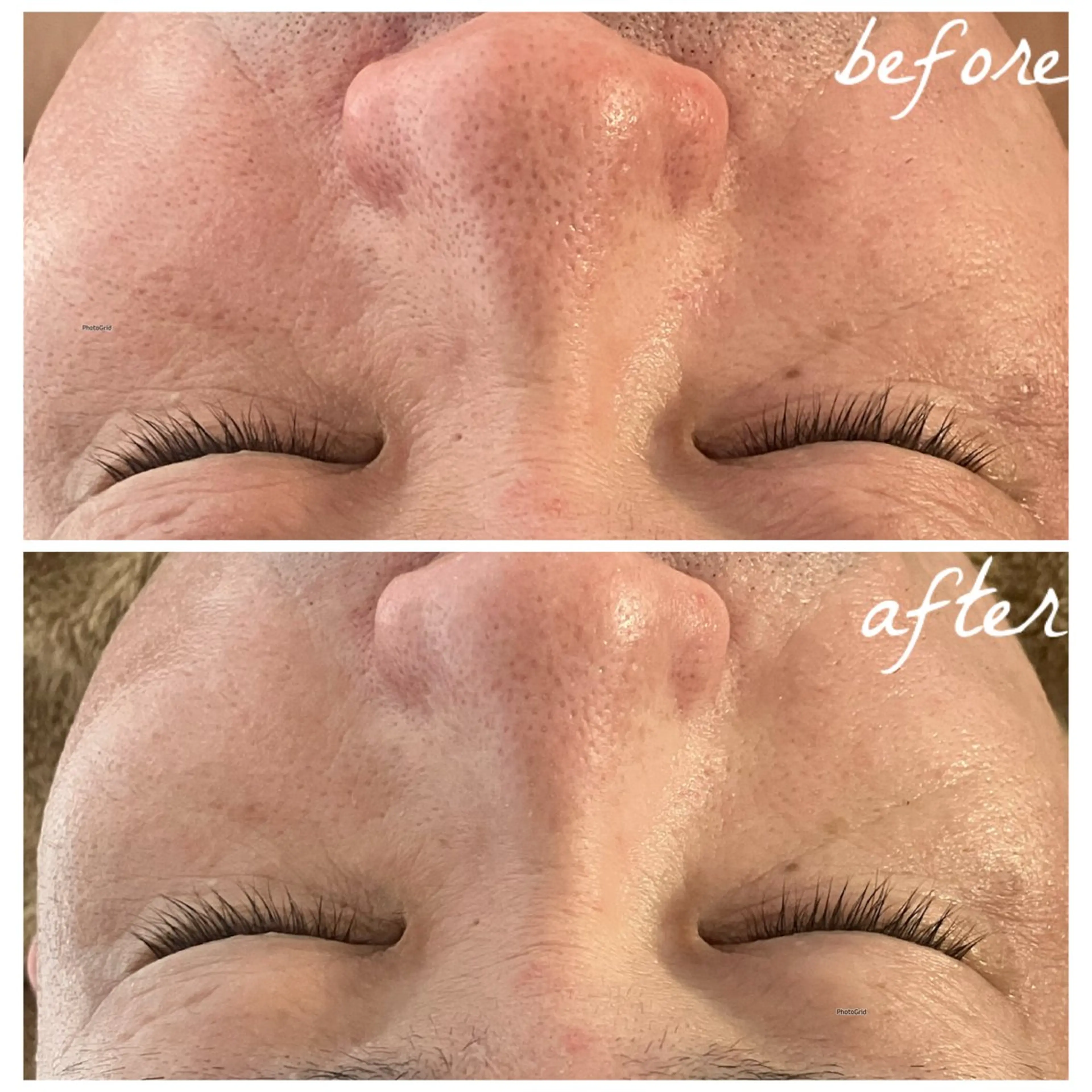 メンズ エステ メナード岐阜市茜部 杉浦のエステ・リラクイメージ