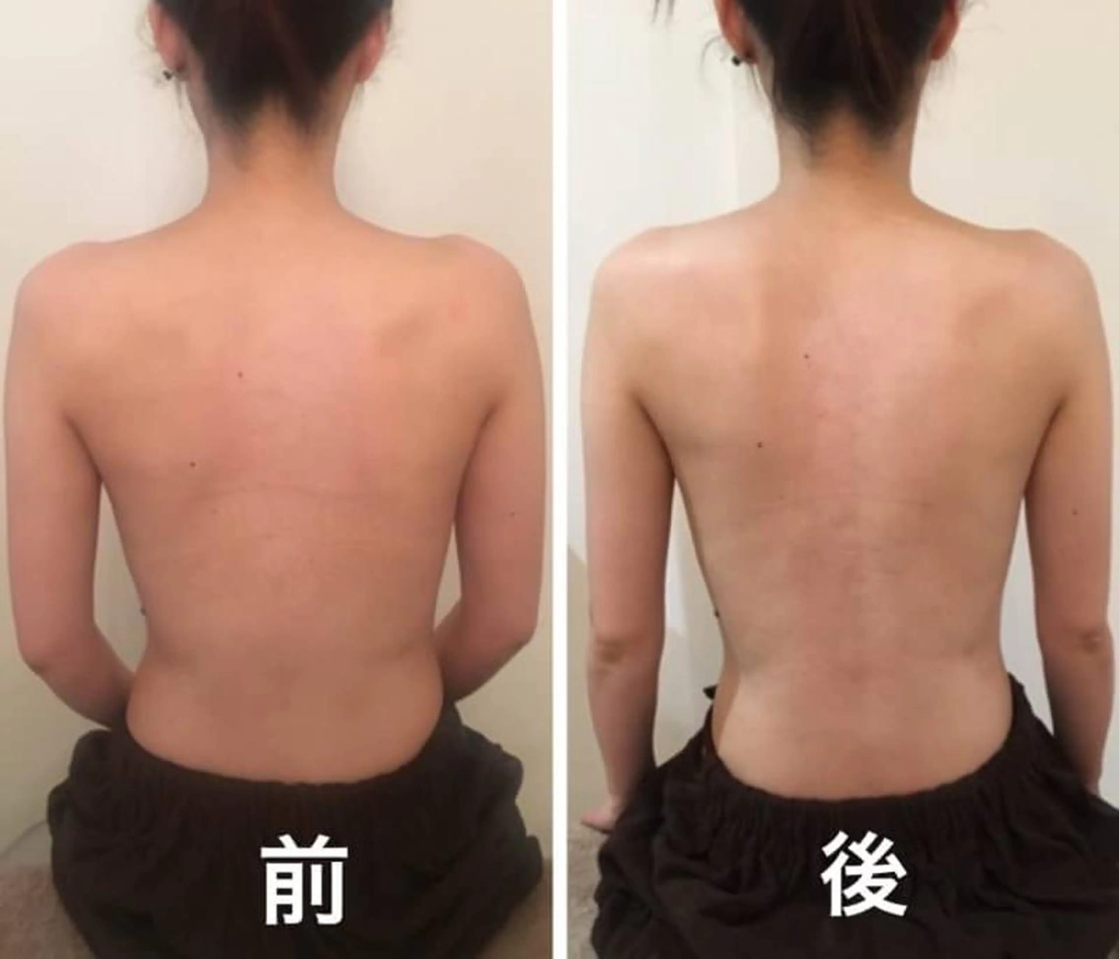 【ブライダルおすすめ】小顔矯正コルギボディエステ100分コースの写真