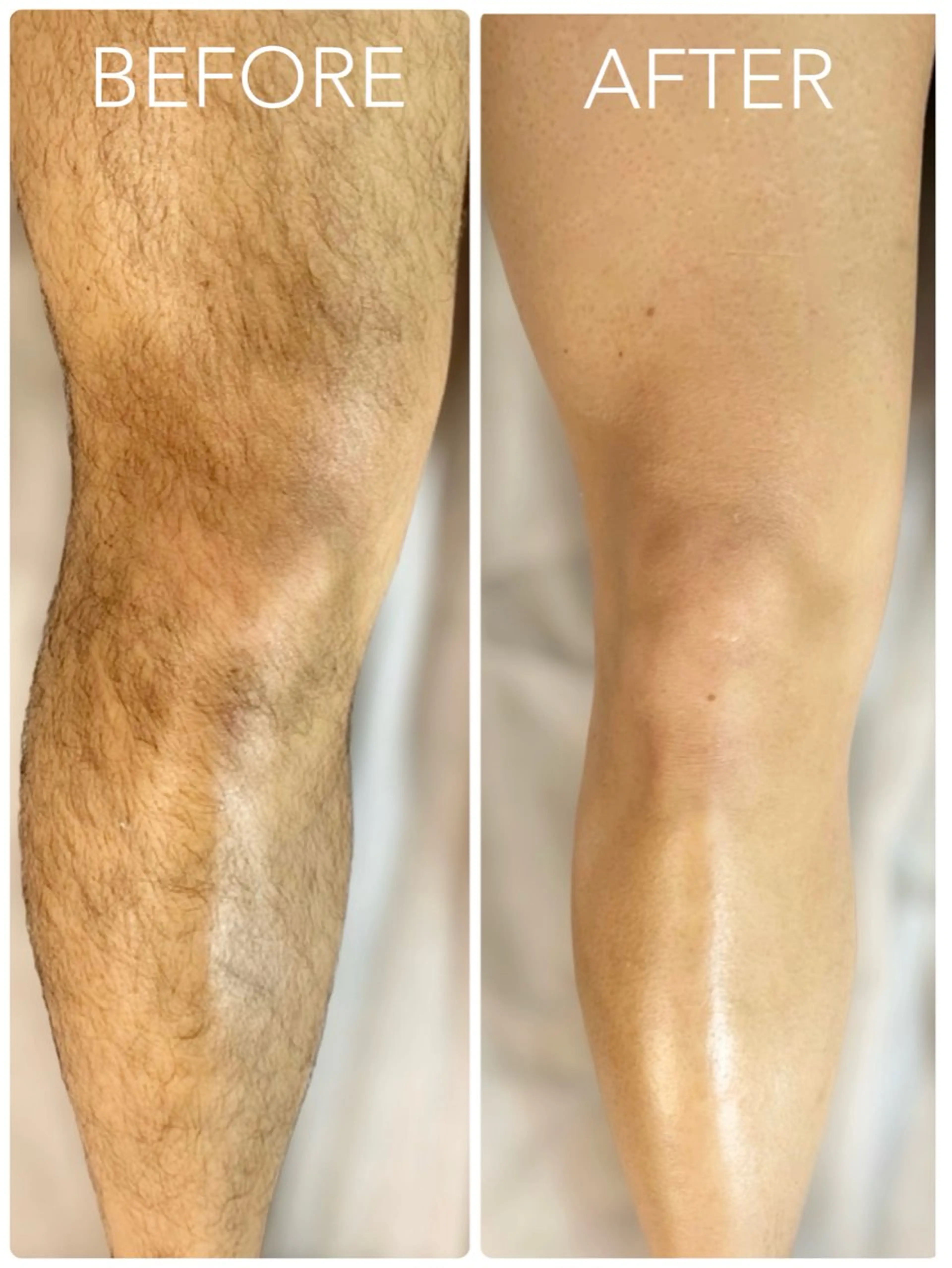 メンズ TREE WAX脱毛のエステ・リラクイメージ