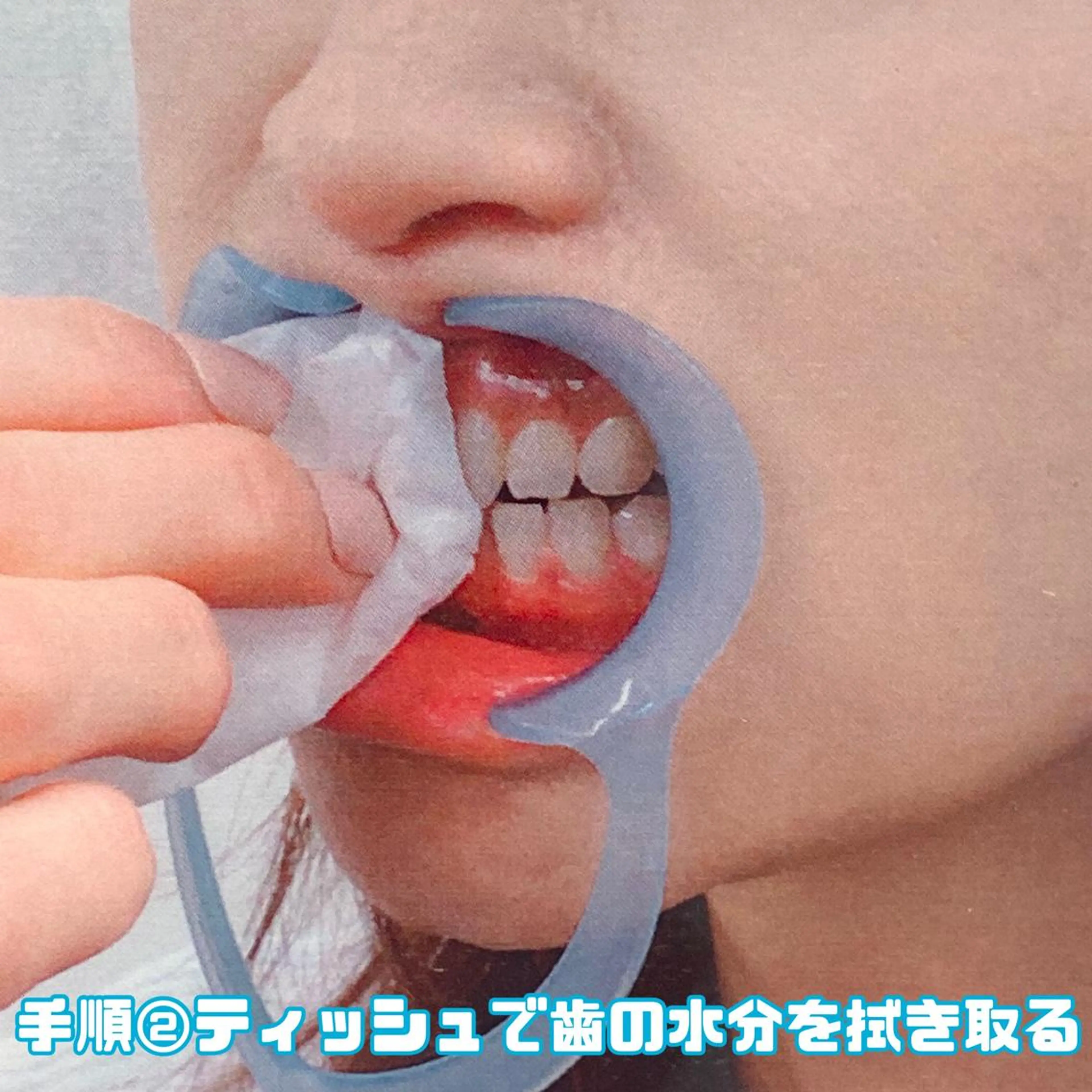 LBSホワイトニング 🌐渋谷店スタッフのエステ・リラクイメージ