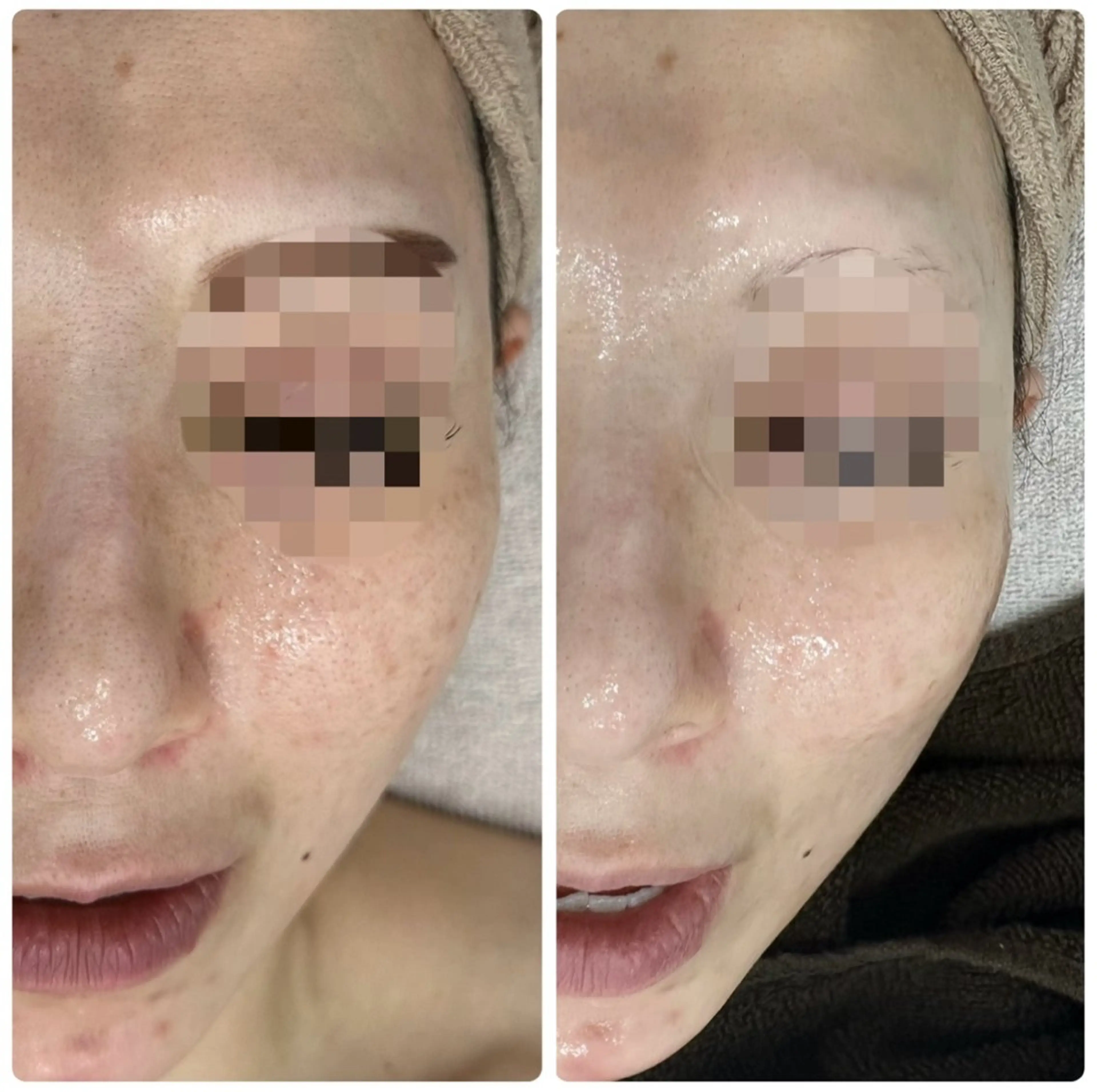 エステ NAVI 韓国肌管理所属・NAVI韓国肌管理《 毛穴/艶肌/小顔》のエステ・リラクイメージ