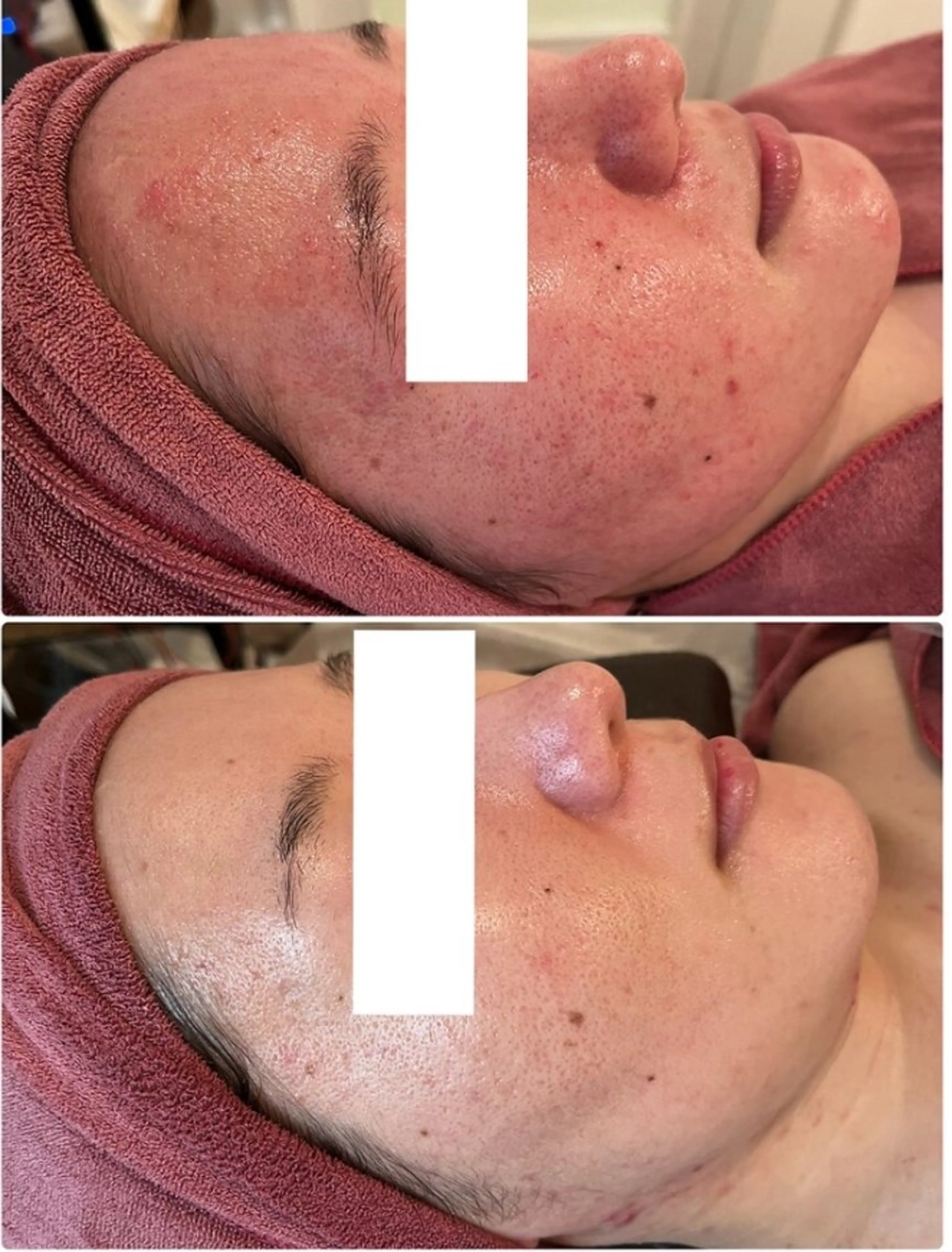 Beauty Max所属・Beauty Max 大石のエステ・リラクイメージ