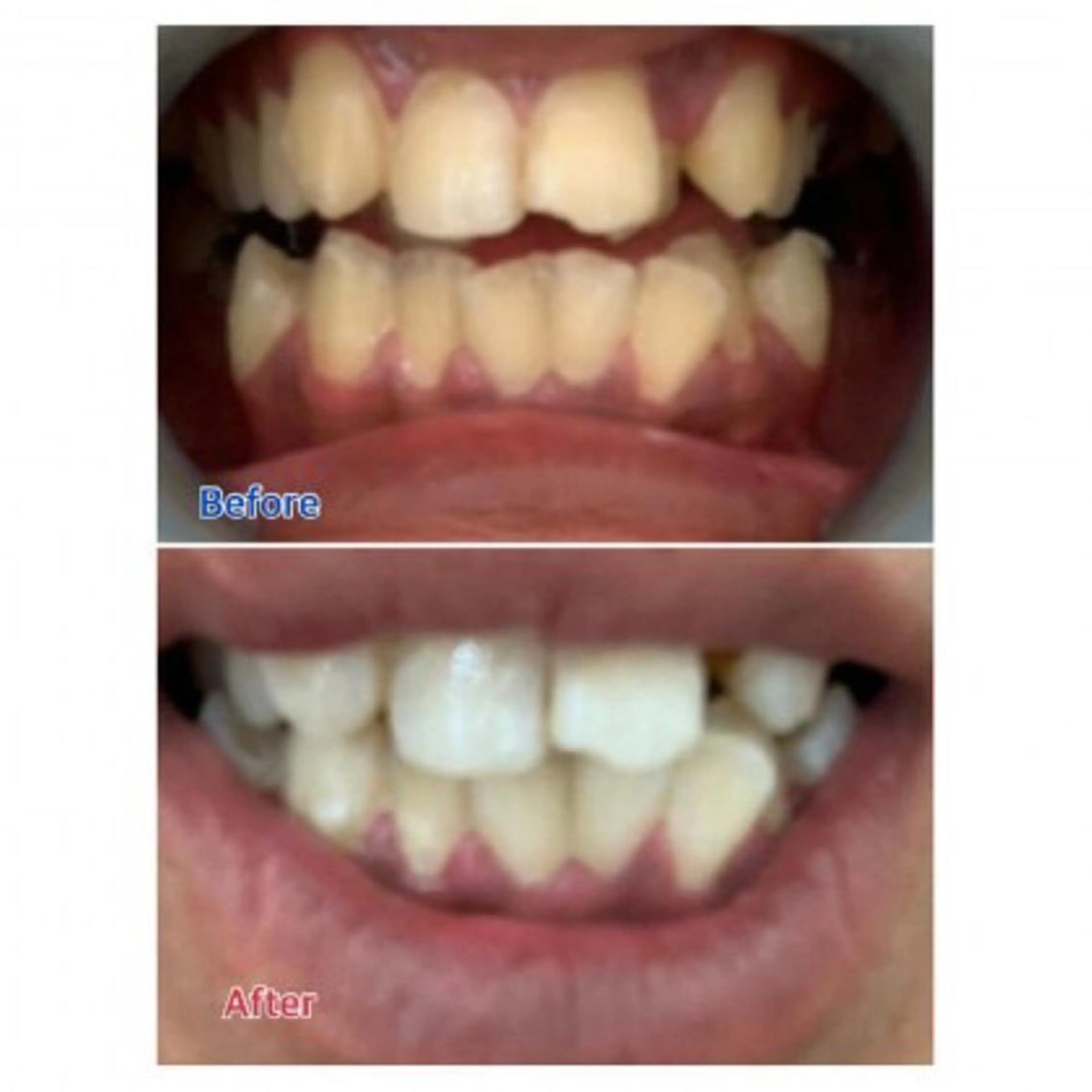 M渋谷店所属・Ｍ渋谷 ホワイトニングのエステ・リラクイメージ