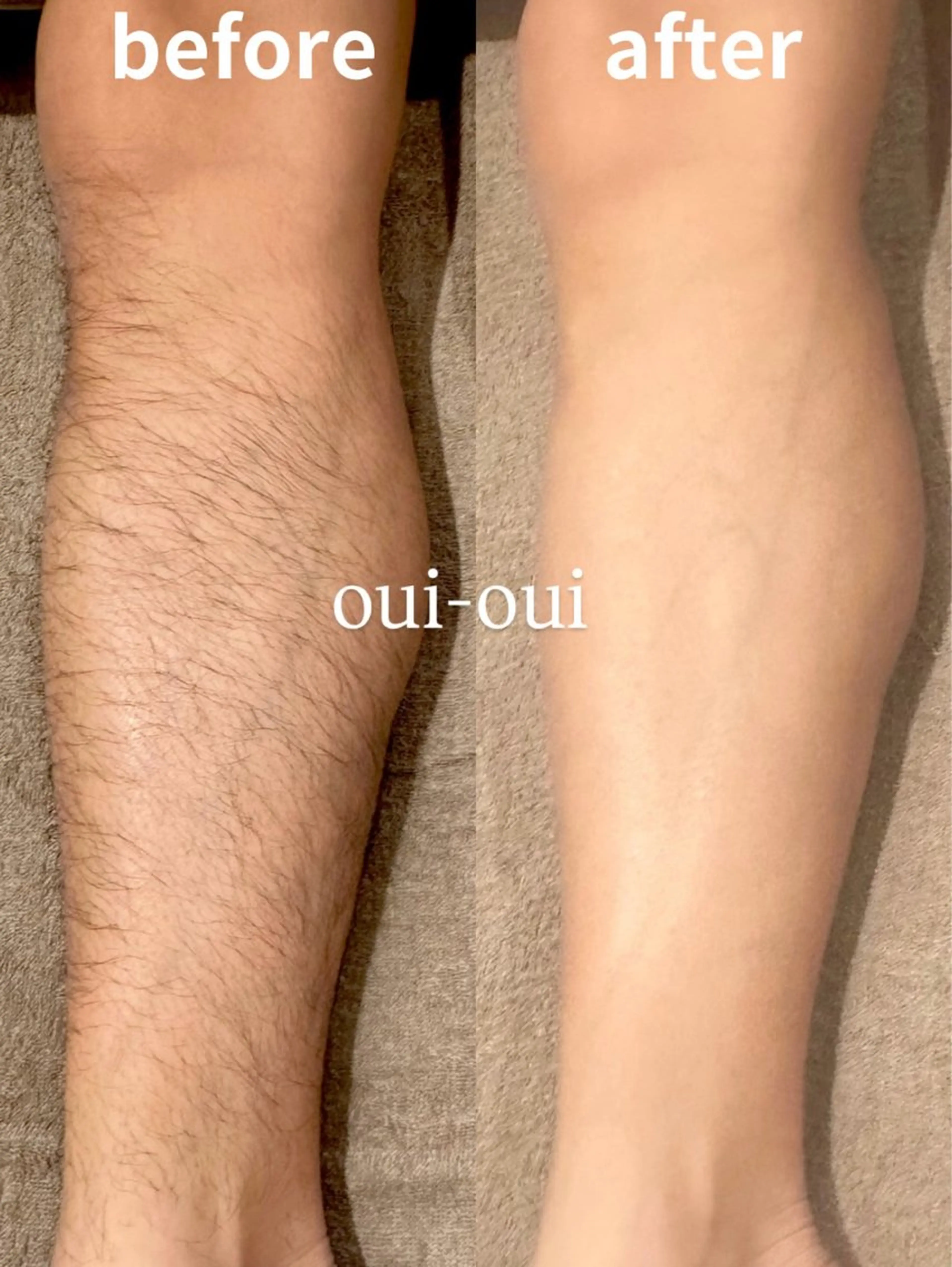 oui-oui　ウィウィ所属・oui-oui 磐田脱毛のエステ・リラクイメージ