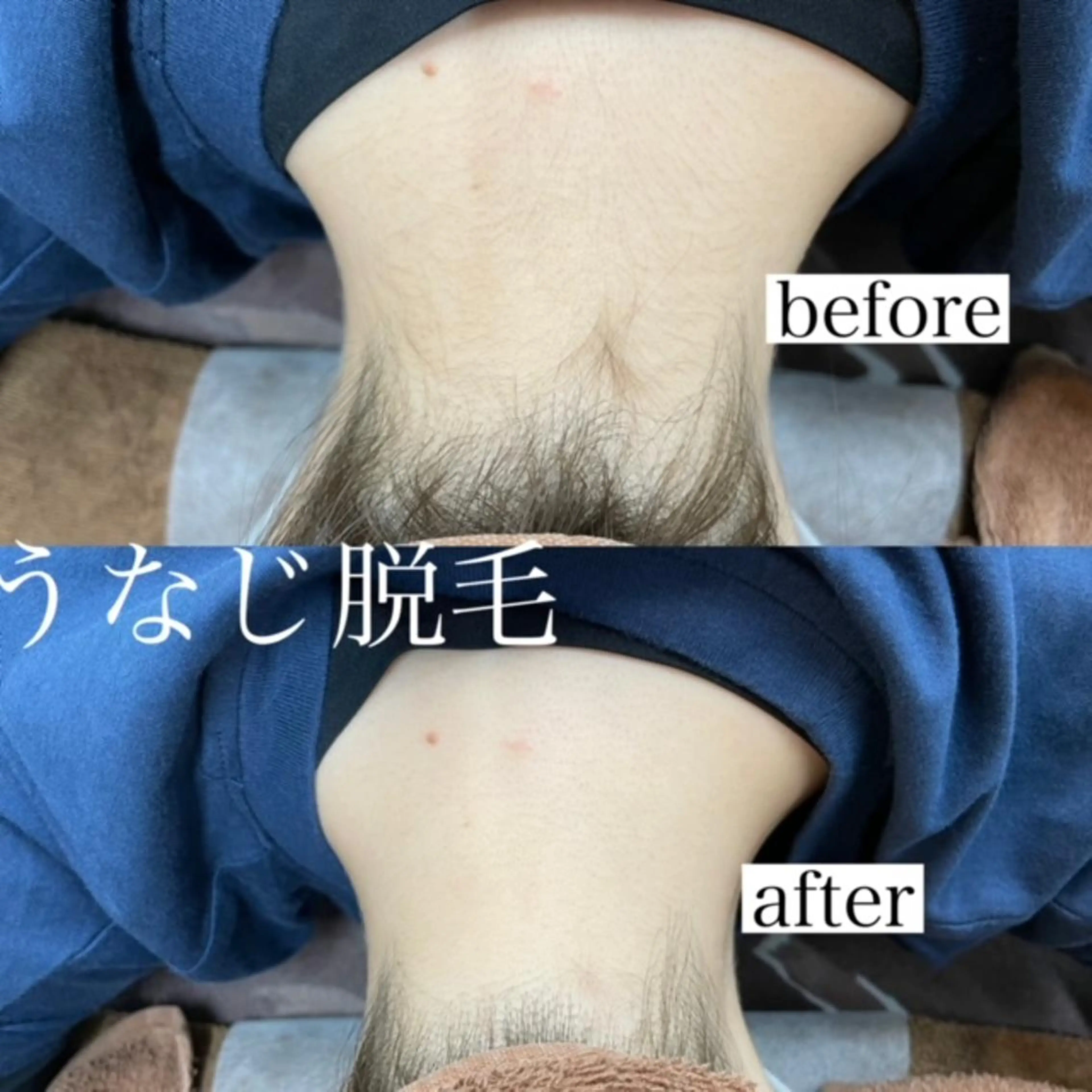 RinRin 甲府昭和店のエステ・リラクイメージ