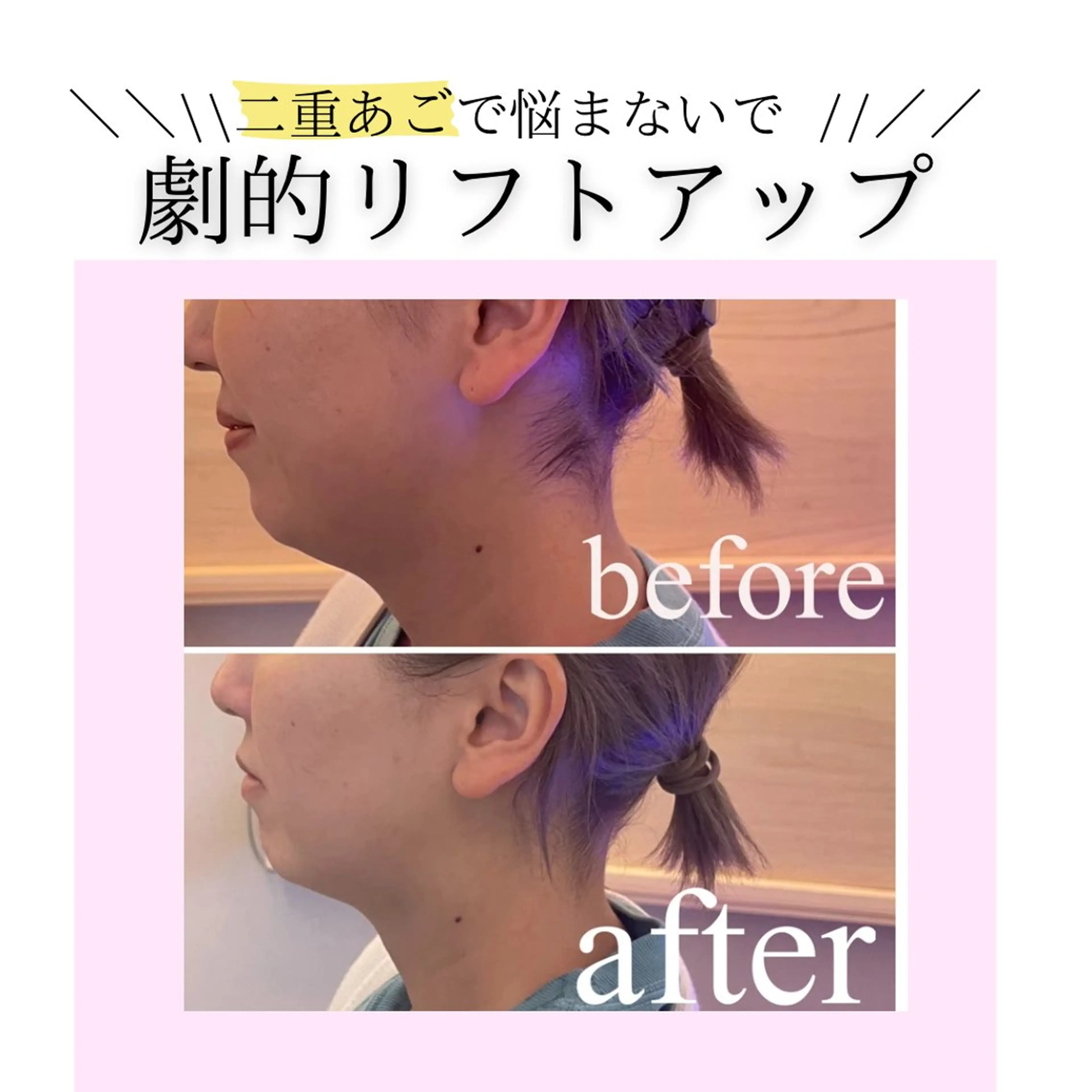 小顔・リフトアップ/ 奈緒美のエステ・リラクイメージ