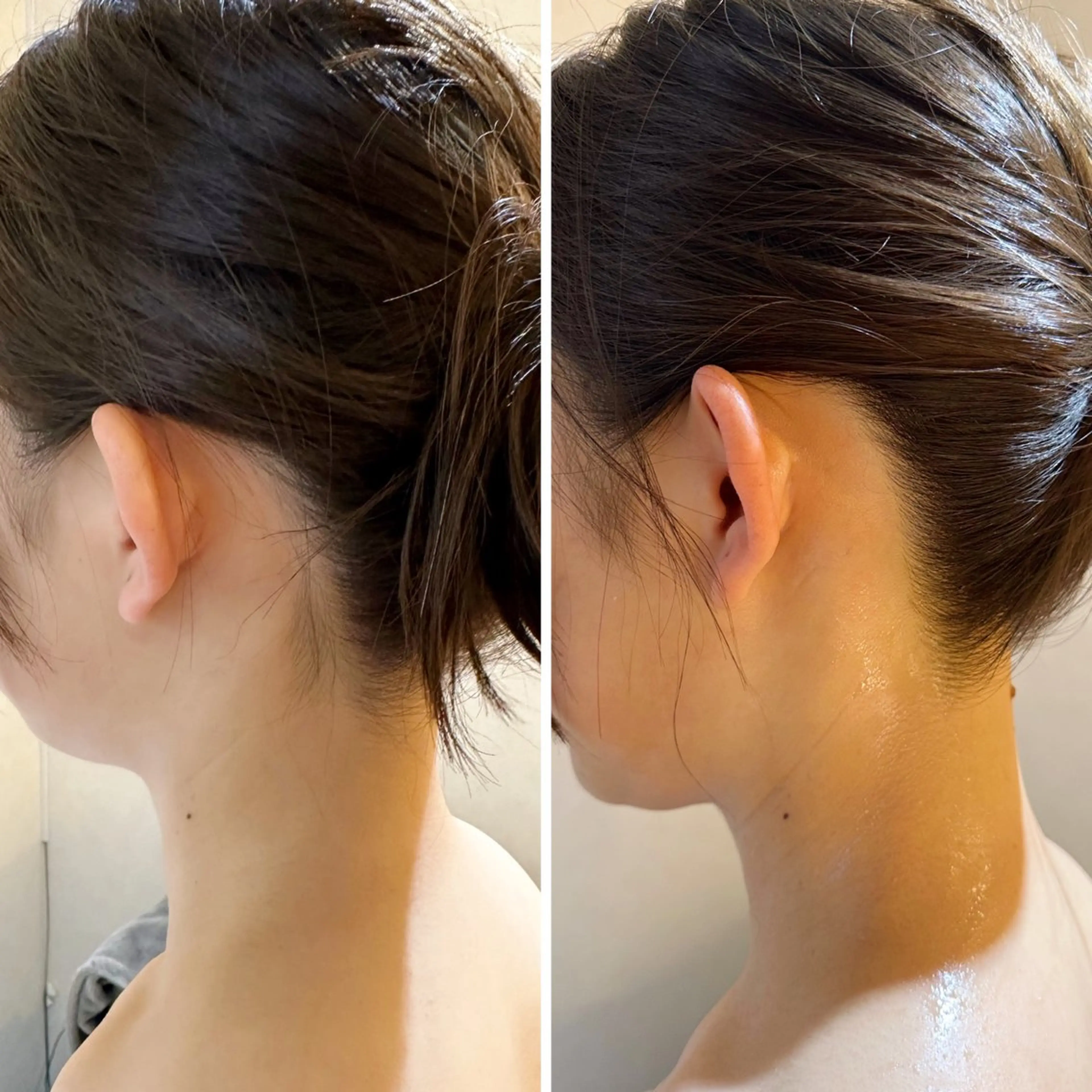 脱毛 うなじ脱毛/美肌脱毛 LABELのエステ・リラクイメージ