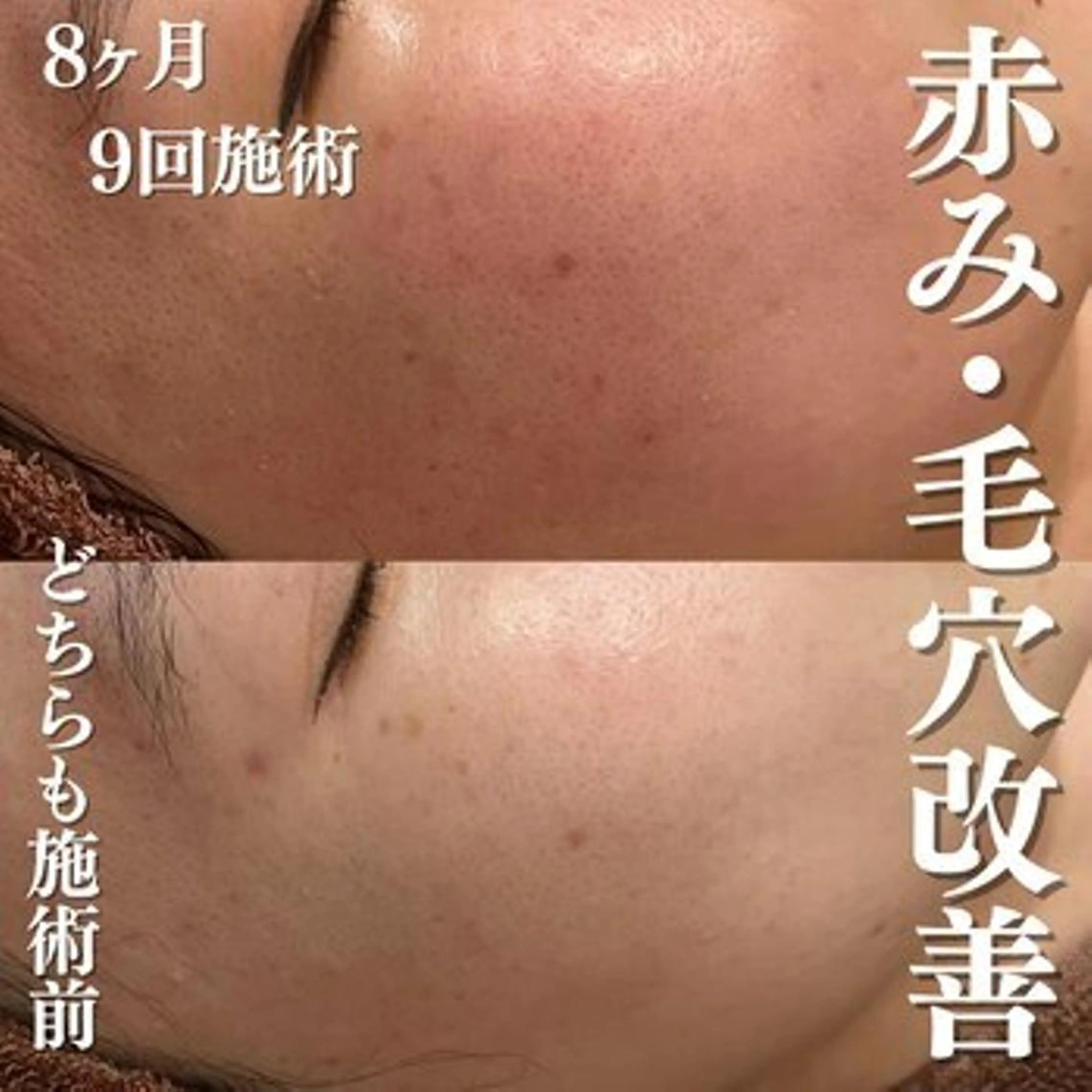 触れたくなる モテ肌へ...❤︎のエステ・リラクイメージ