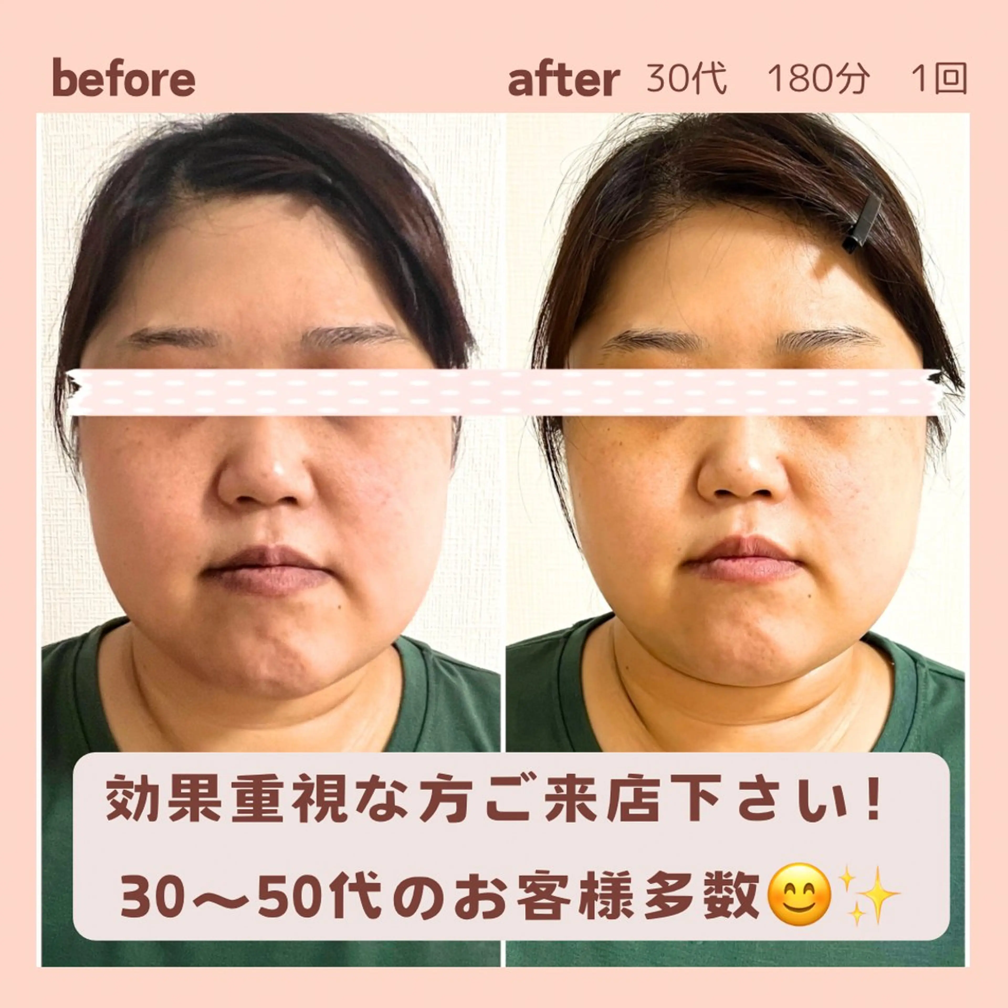 小顔矯正& 慢性肩こり腰痛改善店のエステ・リラクイメージ