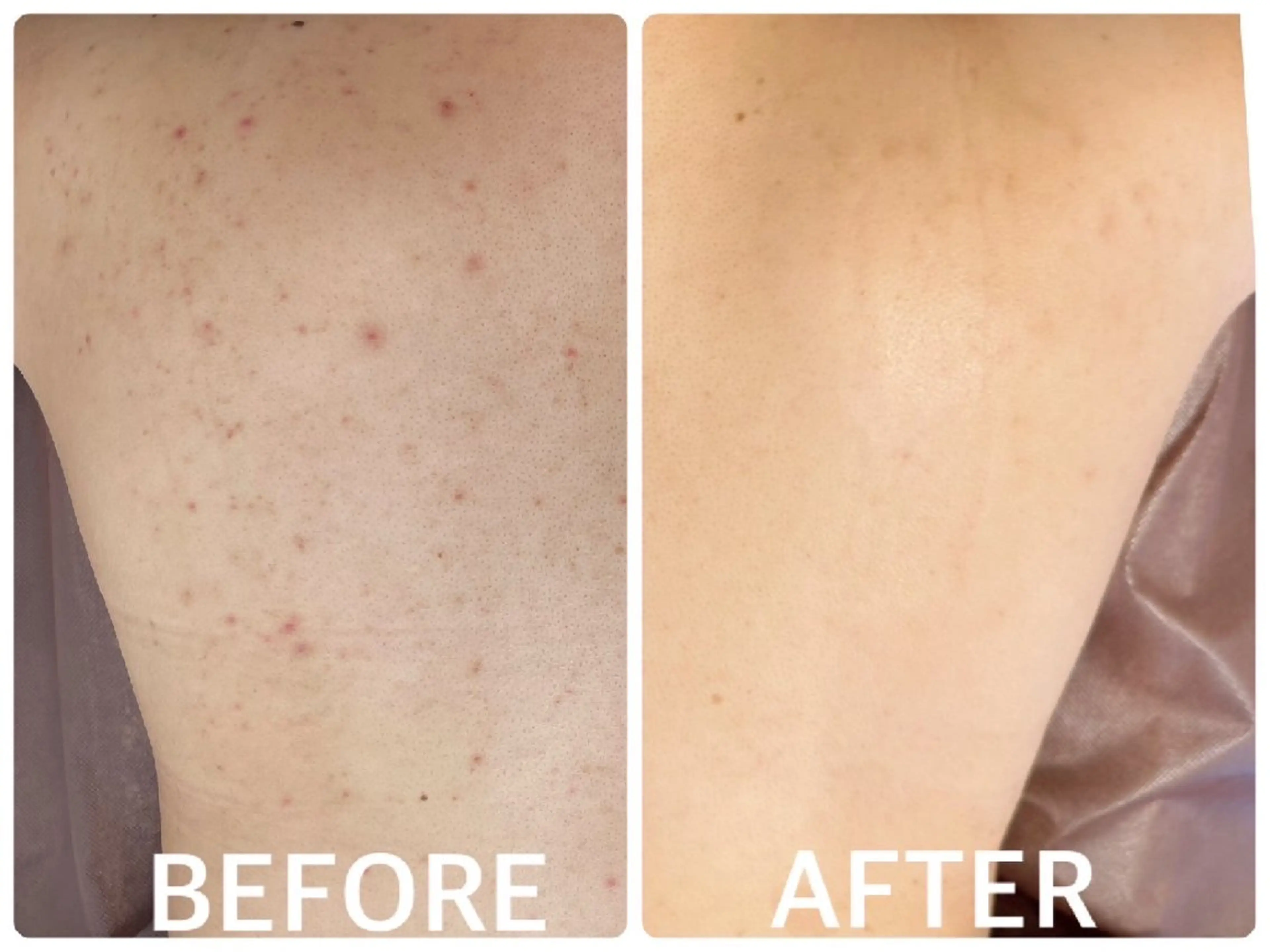 ハーブピーリング横浜 肌質改善専門店のその他イメージ