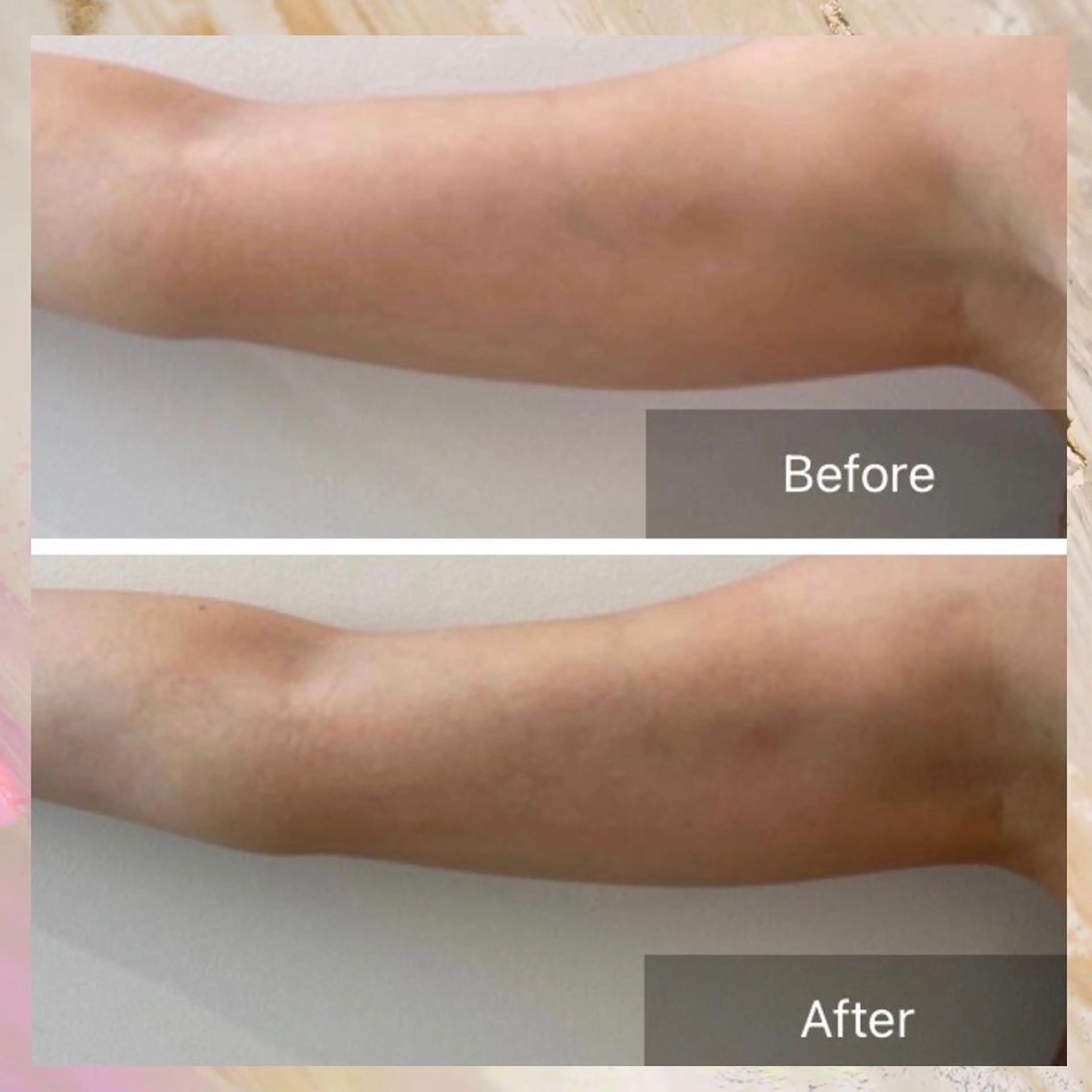 Lumiere despoir所属・Lumiere despoirのエステ・リラクイメージ