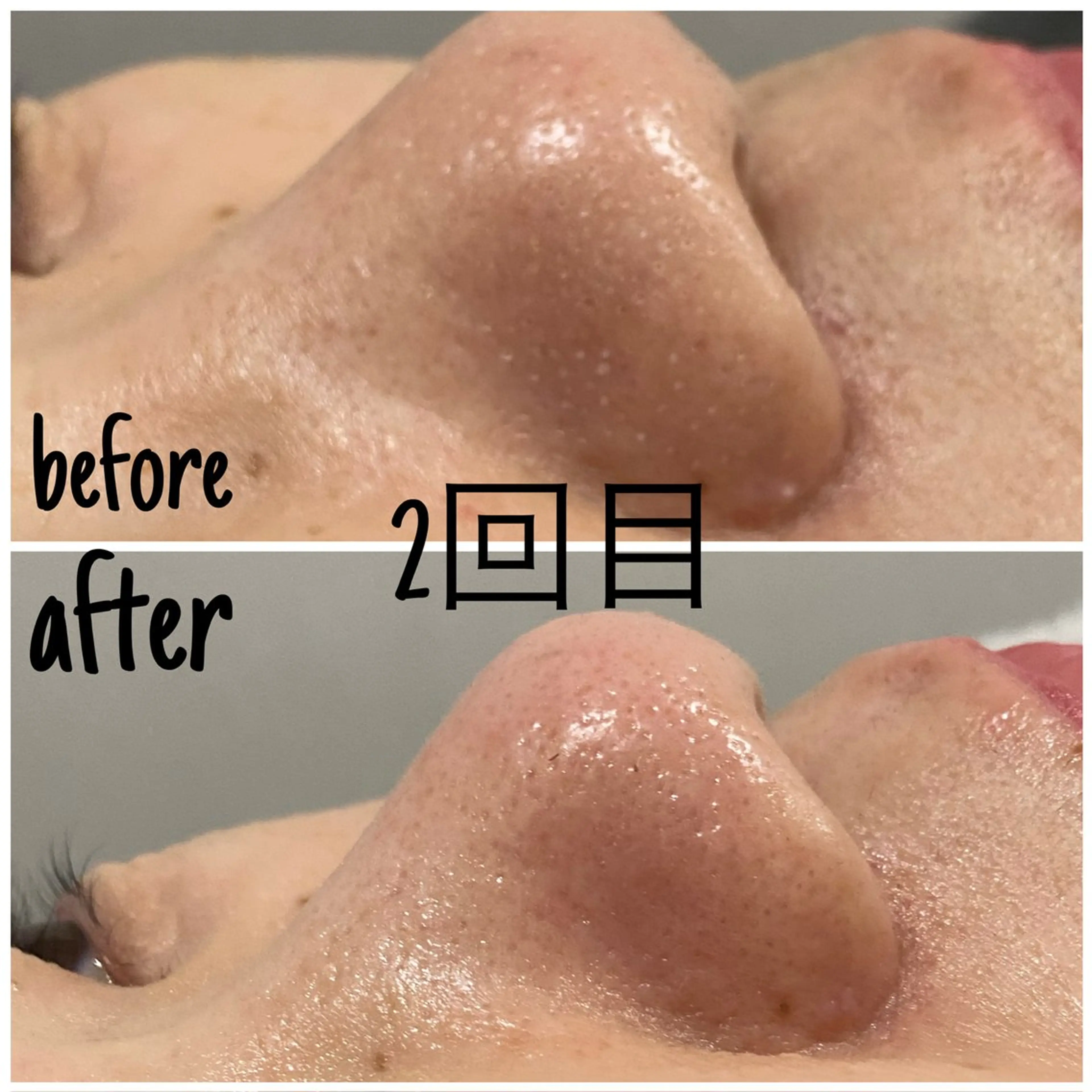 エステ 毛穴洗浄・痩身・脱毛 /アルカンジュのエステ・リラクイメージ