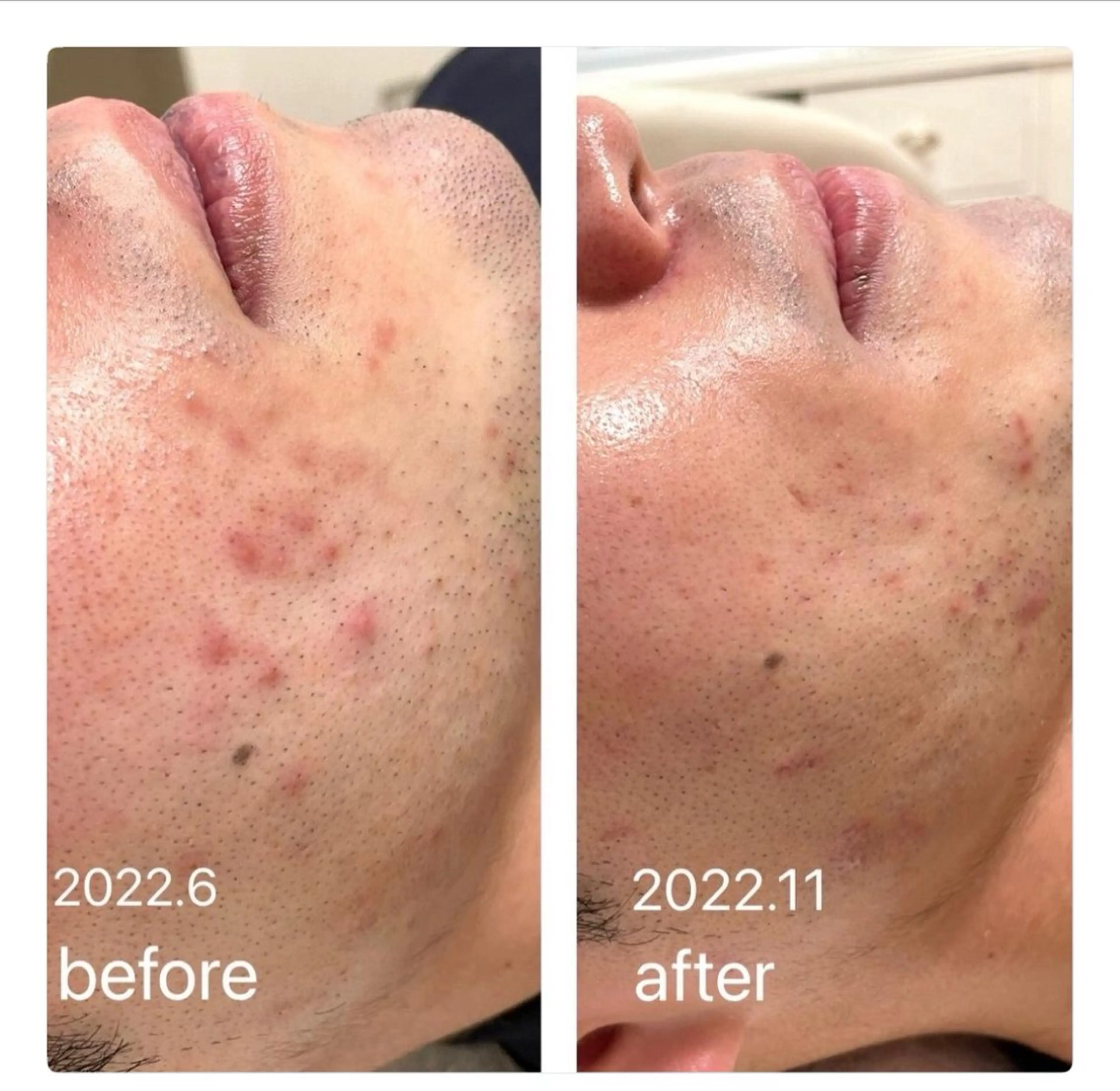 【堺市/泉ヶ丘駅】フェイシャルエステサロンSalon de jewel'm所属・Salon de jewel'm なおのエステ・リラクイメージ