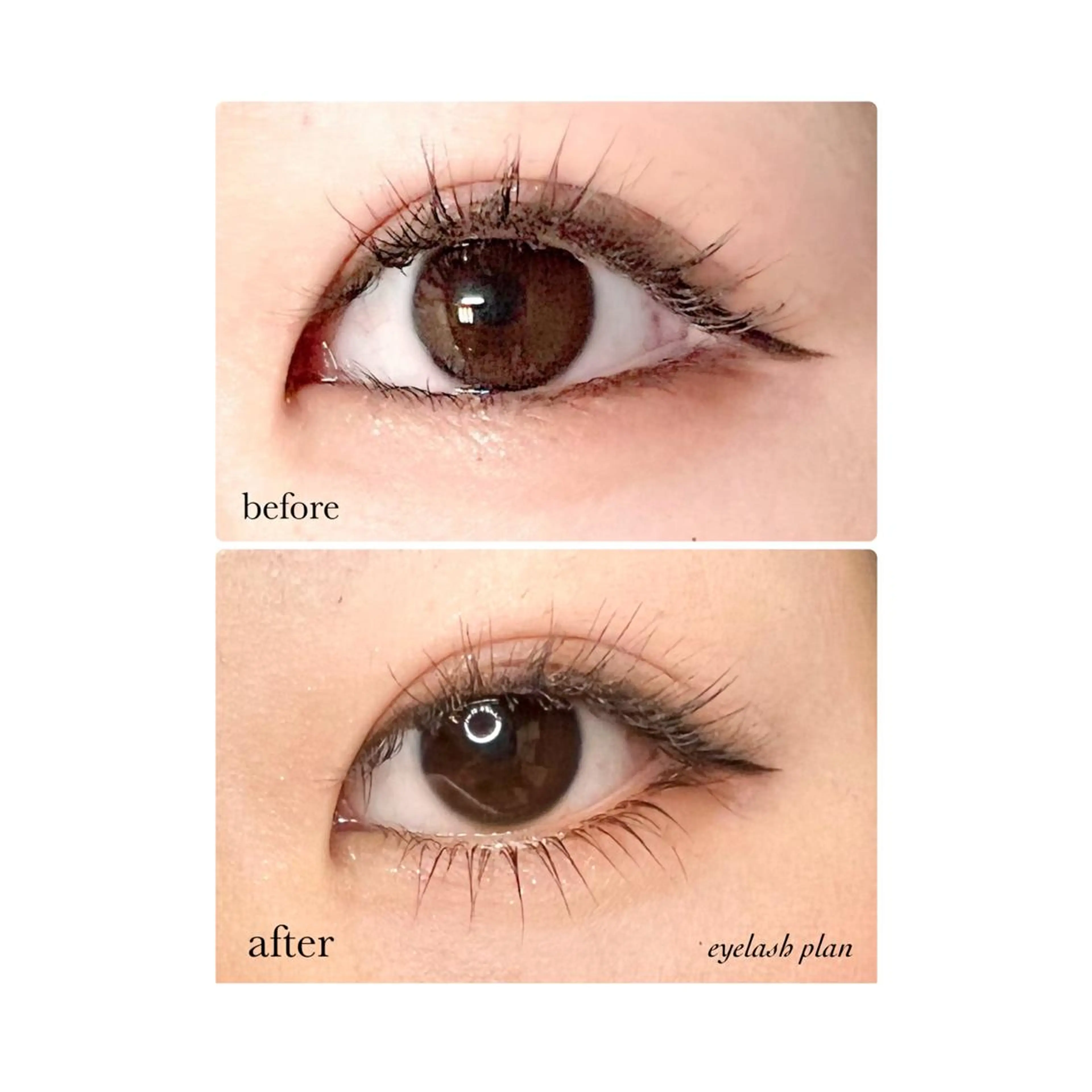 下マツパの写真