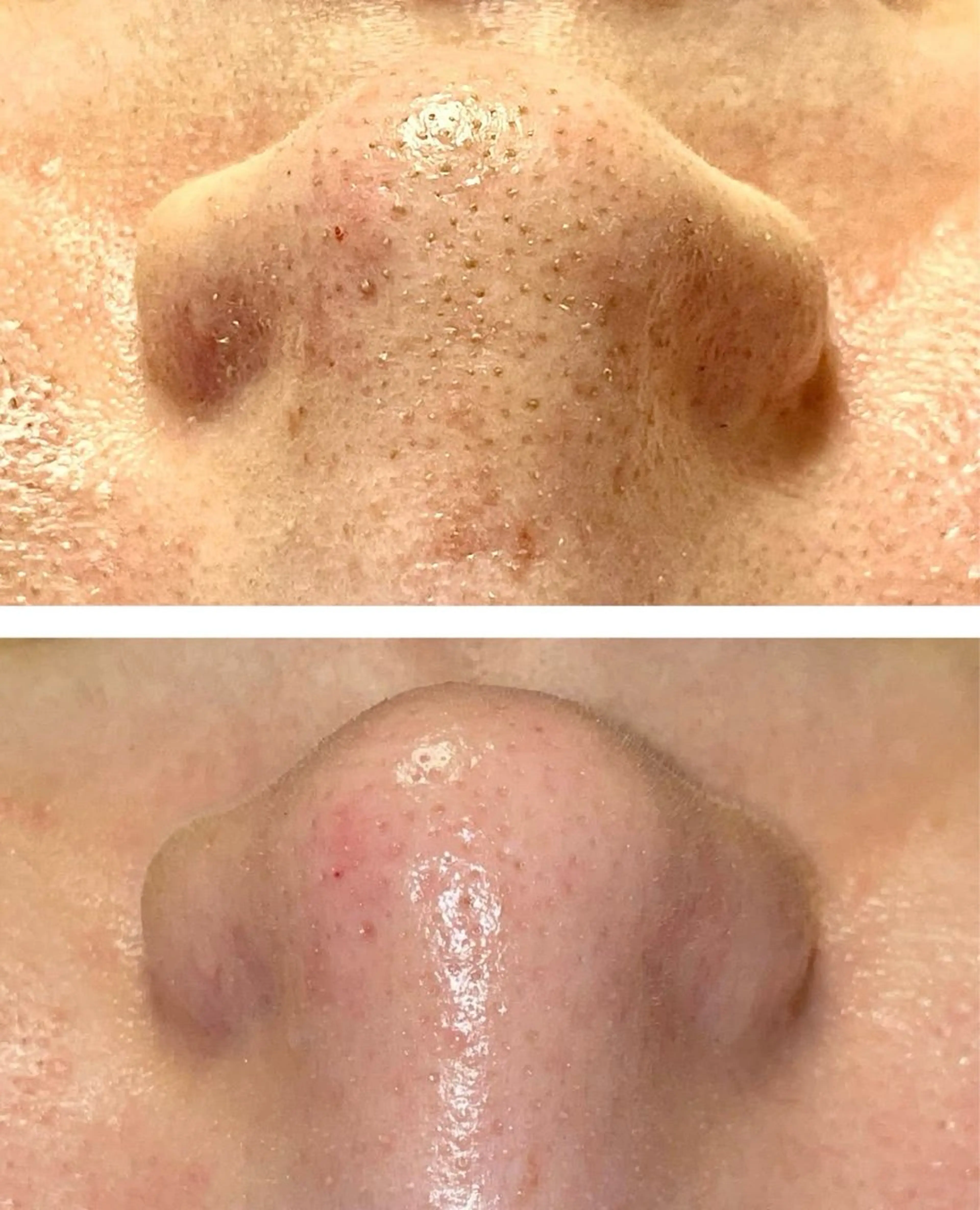 SOLUNA目黒店所属・小顔/毛穴洗浄/痩身 ayako🌿のエステ・リラクイメージ