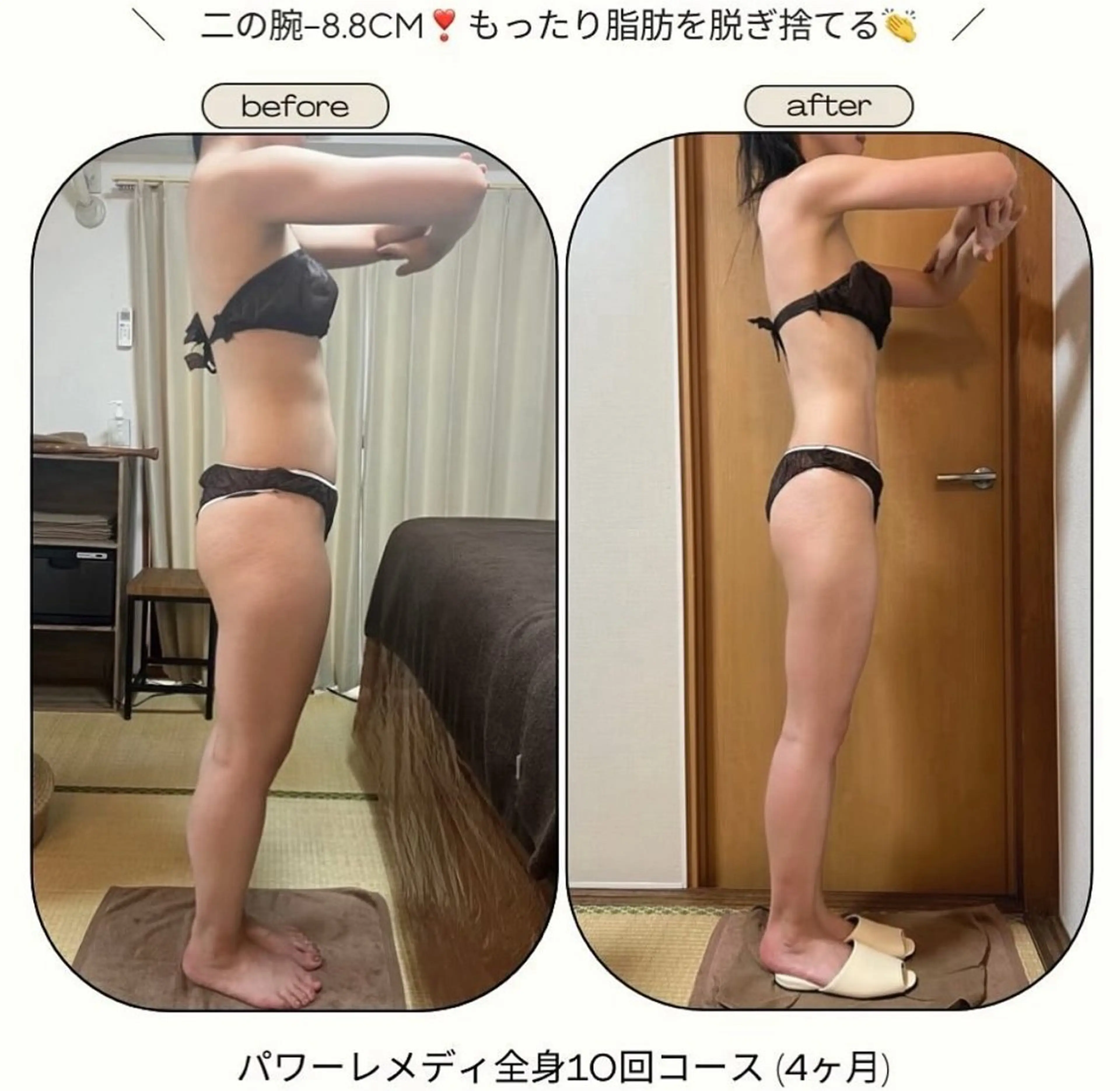 [半身10回コース] 4ヶ月で激痩せ✨発汗付！一部位じゃ物足りない方🌿 気になる二部位の集中コース🤍の写真
