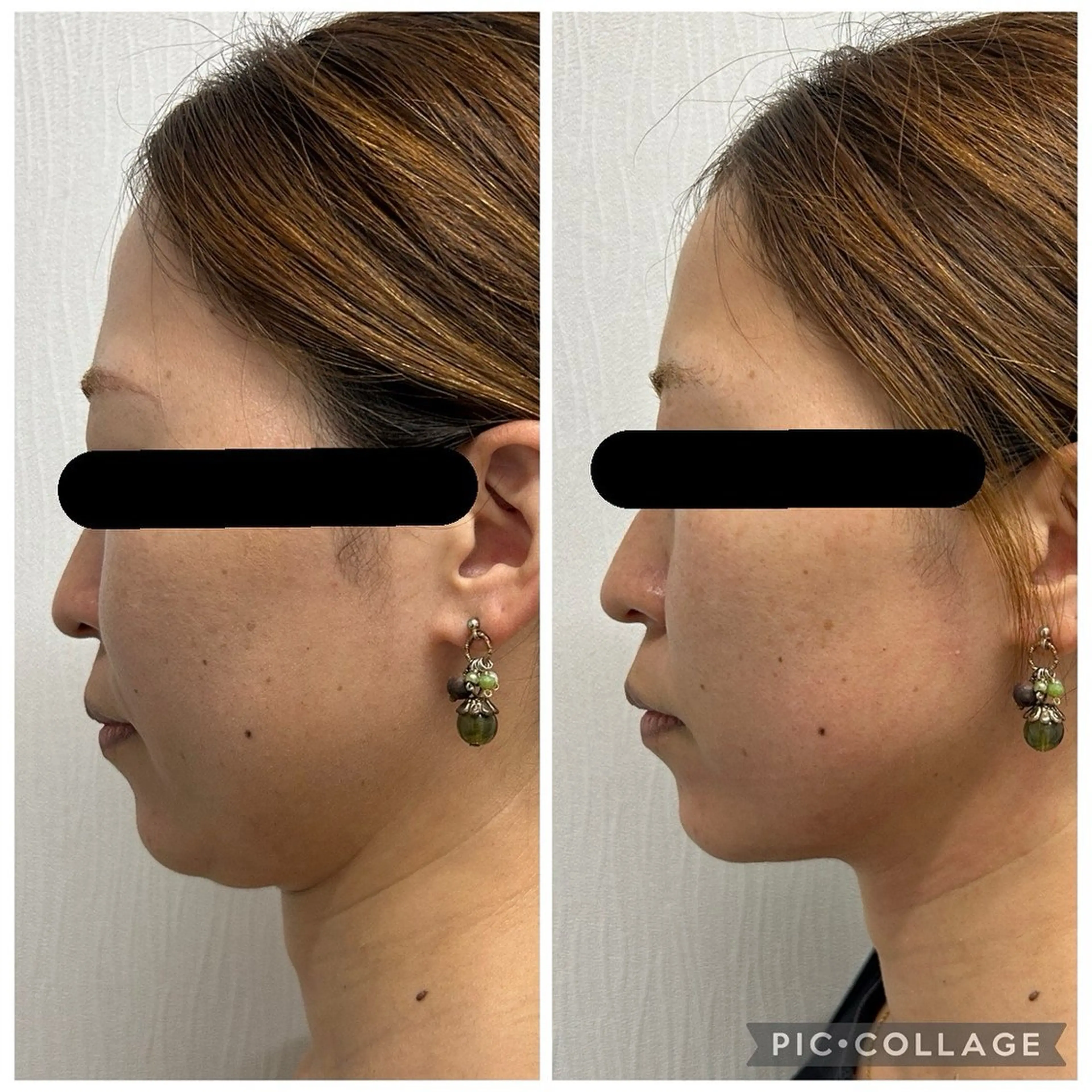 その他 BeautySalonGemmy所属・Gemmy 愛美のエステ・リラクイメージ