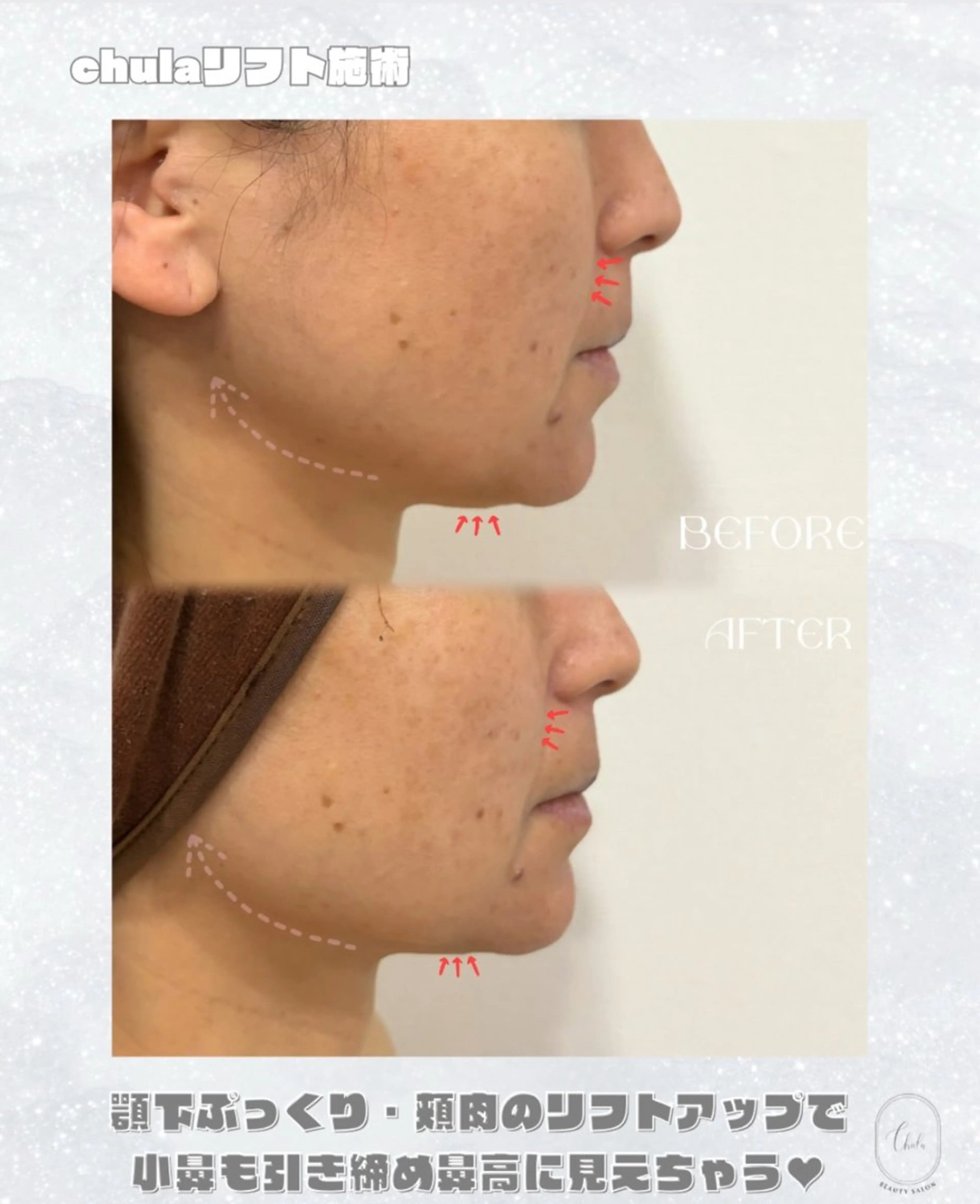 エステ chulanail所属・arisa .のエステ・リラクイメージ